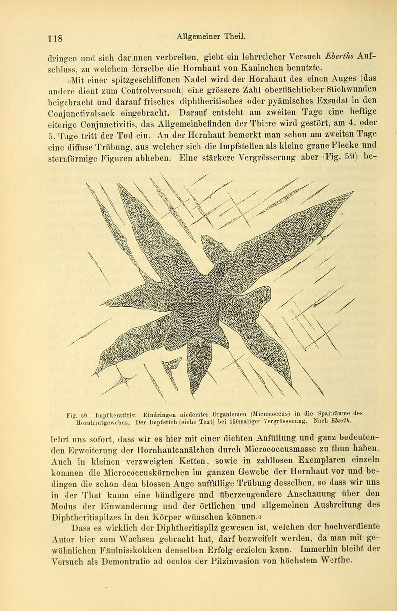 dringen und sich darinnen verbreiten, giebt ein lehrreicher Versuch Eberths Auf- schluss, zu welchem derselbe die Hornhaut von Kaninchen benutzte. »Mit einer spitzgeschliffenen Nadel wird der Hornhaut des einen Auges (das andere dient zum Controlversuch; eine grössere Zahl oberflächlicher Stichwunden beigebracht und darauf frisches diphtherisches oder pyämisches Exsudat in den Conjunctivalsack eingebracht. Darauf entsteht am zweiten Tage eine heftige eiterige Conjunctivitis, das Allgemeinbefinden der Thiere wird gestört, am 4. oder 5. Tage tritt der Tod ein. An der Hornhaut bemerkt man schon am zweiten Tage eine diffuse Trübung, aus welcher sich die Impfstellen als kleine graue Flecke und sternförmige Figuren abheben. Eine stärkere Vergrösserung aber (Fig. 59) be- Fig. 59. Impfkeratitis: Eindringen niederster Organismen (Micrococcus) in die Spalträume des Hornhautgewebes. Der Impfstich (siehe Text) bei 150maliger Vergrösserung. Nach Eberth. lehrt uns sofort, dass wir es hier mit einer dichten Anfüllung und ganz bedeuten- den Erweiterung der Hornhautcanälchen durch Micrococcusmasse zu thun haben. Auch in kleinen verzweigten Ketten, sowie in zahllosen Exemplaren einzeln kommen die Micrococcuskörnchen im ganzen Gewebe der Hornhaut vor und be- dingen die schon dem blossen Auge auffällige Trübung desselben, so dass wir uns in der That kaum eine bündigere und überzeugendere Anschauung über den Modus der Einwanderung und der örtlichen und allgemeinen Ausbreitung des Diphtheritispilzes in den Körper wünschen können.« Dass es wirklich der Diphtheritispilz gewesen ist, welchen der hochverdiente Autor hier zum Wachsen gebracht hat, darf bezweifelt werden, da man mit ge- wöhnlichen Fäulnisskokken denselben Erfolg erzielen kann. Immerhin bleibt der Versuch als Demontratio ad oculos der Pilzinvasion von höchstem Werthe.