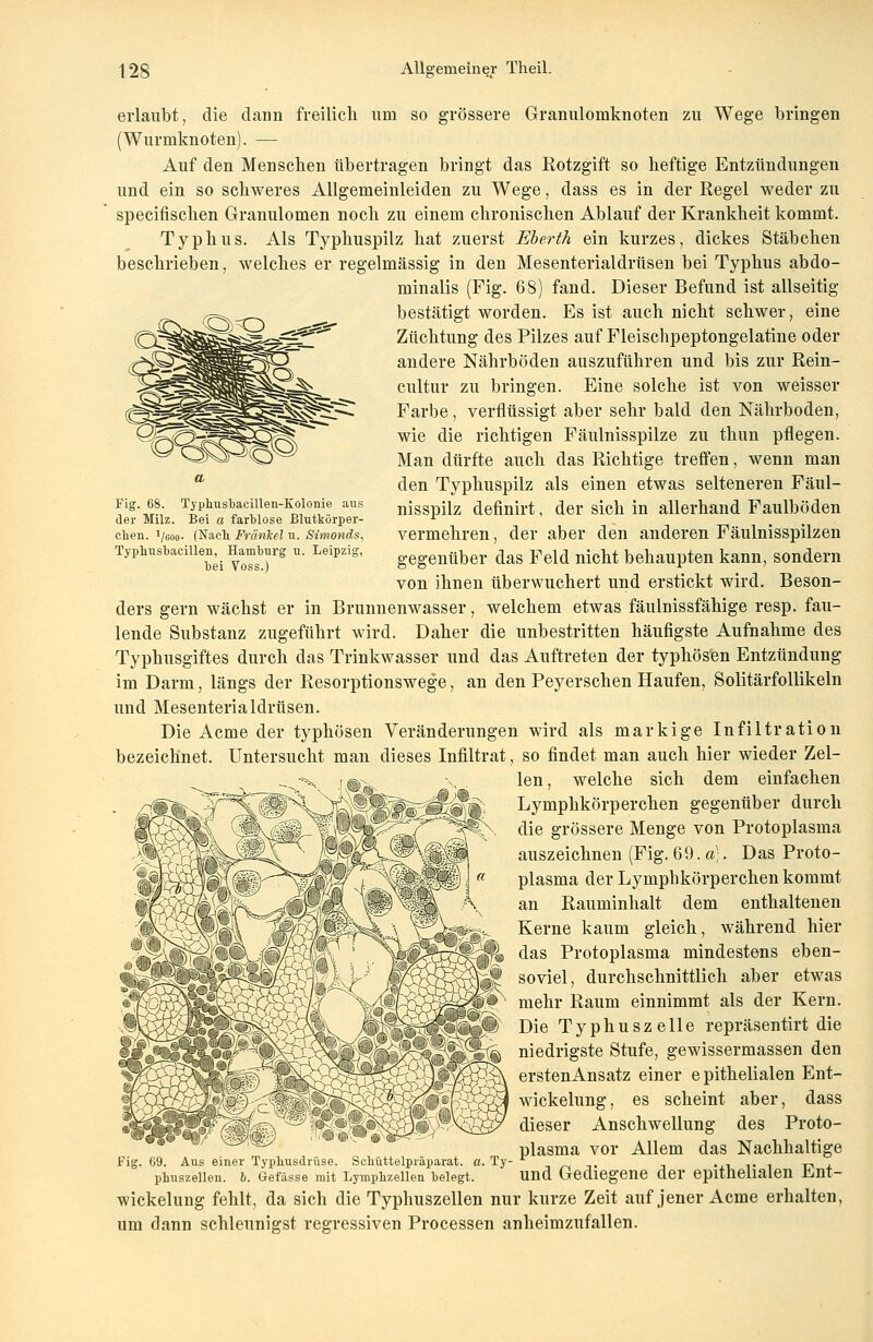 Fig. 68. Typhusbacillen-Kolonie aus der Milz. Bei a farblose Blutkörper- chen. Vsoo- (Nach Fränkel u. Simonds, Typliusbacillen, Hamburg u. Leipzig, bei Voss.) erlaubt, die dann freilich um so grössere Granuloraknoten zu Wege bringen (Wurmknoten). — Auf den Menseben übertragen bringt das Rotzgift so heftige Entzündungen und ein so schweres Allgemeinleiden zu Wege, dass es in der Regel weder zu speeifischen Granulomen noch zu einem chronischen Ablauf der Krankheit kommt. Typhus. Als Typhuspilz hat zuerst Eberth ein kurzes, dickes Stäbchen beschrieben, welches er regelmässig in den Mesenterialdrüsen bei Typhus abdo- minalis (Fig. 68) fand. Dieser Befund ist allseitig bestätigt worden. Es ist auch nicht schwer, eine Züchtung des Pilzes auf Fleischpeptongelatine oder andere Nährböden auszuführen und bis zur Rein- cultur zu bringen. Eine solche ist von weisser Farbe, verflüssigt aber sehr bald den Nährboden, wie die richtigen Fäulnisspilze zu thim pflegen. Man dürfte auch das Richtige treffen, wenn man den Typhuspilz als einen etwas selteneren Fäul- nisspilz definirt, der sich in allerhand Faulböden vermehren, der aber den anderen Fäulnisspilzen gegenüber das Feld nicht behaupten kann, sondern von ihnen überwuchert und erstickt wird. Beson- ders gern wächst er in Brunnenwasser, welchem etwas fäulnissfähige resp. fau- lende Substanz zugeführt wird. Daher die unbestritten häufigste Aufnahme des Typhusgiftes durch das Trinkwasser und das Auftreten der typhösen Entzündung im Darm, längs der Resorptionswege, an den Peyerschen Haufen, Solitärfollikeln und Mesenterialdrüsen. Die Acme der typhösen Veränderungen wird als markige Infiltration bezeichnet. Untersucht man dieses Infiltrat, so findet man auch hier wieder Zel- len, welche sich dem einfachen Lymphkörperchen gegenüber durch die grössere Menge von Protoplasma auszeichnen (Fig. 69. a). Das Proto- plasma der Lymphkörperchen kommt an Rauminhalt dem enthaltenen Kerne kaum gleich, während hier das Protoplasma mindestens eben- : soviel, durchschnittlich aber etwas W.w mehr Raum einnimmt als der Kern. Die Typhuszelle repräsentirt die niedrigste Stufe, gewissermassen den erstenAnsatz einer epithelialen Ent- wickelung, es scheint aber, dass dieser Anschwellung des Proto- plasma vor Allem das Nachhaltige Fig. 69. Aus einer Typbusdrüse. Schüttelpräparat, a. Ty- r . , ... „ , phuszeiien. 6. Gefässe mit Lymphzellen belegt. und Gediegene der epithelialen ünt- wickelung fehlt, da sich die Typhuszellen nur kurze Zeit auf jener Acme erhalten, um dann schleunigst regressiven Processen anheimzufallen.