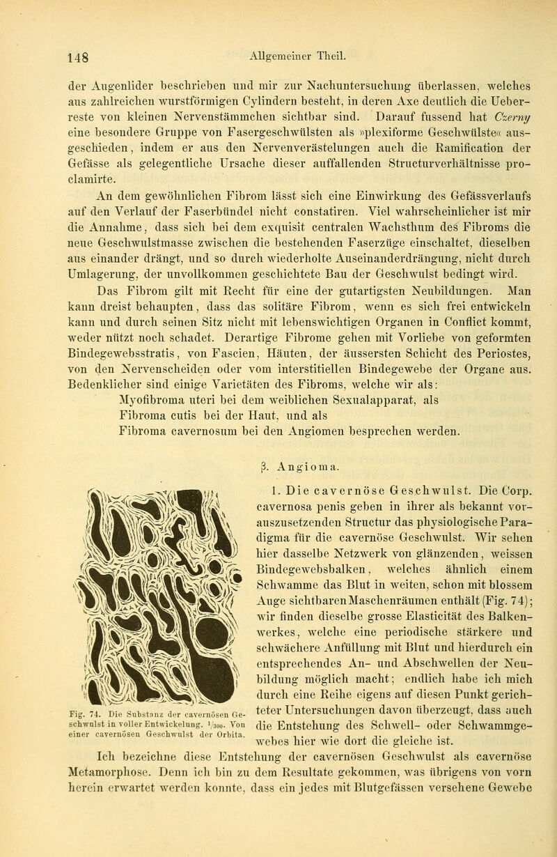 der Augenlider beschrieben und mir zur Nachuntersuchung tiberlassen, welches aus zahlreichen wurstförmigen Cylindern besteht, in deren Axe deutlich die Ueber- reste von kleinen Nervenstämmchen sichtbar sind. Darauf fussend hat Czerny eine besondere Gruppe von Fasergeschwtilsten als »plexiforme Geschwülste« aus- geschieden , indem er aus den Nervenverästelungen auch die Ramification der Gefässe als gelegentliche Ursache dieser auffallenden Structurverhältnisse pro- clamirte. An dem gewöhnlichen Fibrom lässt sich eine Einwirkung des Gefässverlaufs auf den Verlauf der Faserbündel nicht constatiren. Viel wahrscheinlicher ist mir die Annahme, dass sich bei dem exquisit centralen Wachsthum des Fibroms die neue Geschwulstmasse zwischen die bestehenden Faserzüge einschaltet, dieselben aus einander drängt, und so durch wiederholte Auseinanderdrängung, nicht durch Umlagerung, der unvollkommen geschichtete Bau der Geschwulst bedingt wird. Das Fibrom gilt mit Recht für eine der gutartigsten Neubildungen. Man kann dreist behaupten, dass das solitäre Fibrom, wenn es sich frei entwickeln kann und durch seinen Sitz nicht mit lebenswichtigen Organen in Conflict kommt, weder nützt noch schadet. Derartige Fibrome gehen mit Vorliebe von geformten Bindegewebsstratis, von Fascien, Häuten, der äussersten Schicht des Periostes, von den Nervenscheiden oder vom interstitiellen Bindegewebe der Organe aus. Bedenklicher sind einige Varietäten des Fibroms, welche wir als: Myofibroma uteri bei dem weiblichen Sexualapparat, als Fibroma cutis bei der Haut, und als Fibroma cavernosum bei den Angiomen besprechen werden. (3. Angioma. 1. Die cavernöse Geschwulst. Die Corp. cavernosa penis geben in ihrer als bekannt vor- auszusetzenden Structur das physiologische Para- digma für die cavernöse Geschwulst. Wir sehen hier dasselbe Netzwerk von glänzenden, weissen Bindegewebsbalken, welches ähnlich einem Schwämme das Blut in weiten, schon mit blossem Auge sichtbaren Maschenräumen enthält (Fig. 74); wir finden dieselbe grosse Elasticität des Balken- werkes, welche eine periodische stärkere und schwächere Anfüllung mit Blut und hierdurch ein entsprechendes An- und Abschwellen der Neu- tbildung möglich macht; endlich habe ich mich i '7yl':BP*i\*4:^ Jr durch eine Reihe eigens auf diesen Punkt gerich- teter Untersuchungen davon überzeugt, dass auch die Entstehung des Schwell- oder Schwammge- webes hier wie dort die gleiche ist. Ich bezeichne diese Entstehung der cavernösen Geschwulst als cavernöse Metamorphose. Denn ich bin zu dem Resultate gekommen, was übrigens von vorn herein erwartet werden konnte, dass ein jedes mit Blutgefässen versehene Gewebe Fig. 74. Die Substanz der cavernösen Ge- schwulst in voller Entwickelung. ]/3oo- Von einer cavernösen Geschwulst der Orbita.