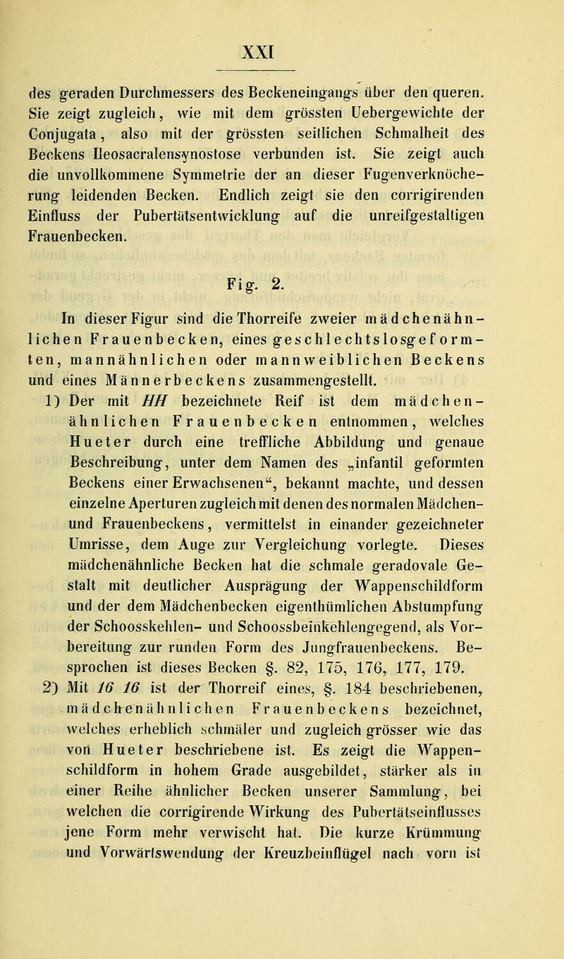 des geraden Durchmessers des Beckeneingaiig-s über den queren. Sie zeigt zugleich, wie mit dem grössten Uebergewichte der Conjugata, also mit der grössten seitlichen Schmalheit des Beckens Ileosacralensynostose verbunden ist. Sie zeigt auch die unvollkommene Symmetrie der an dieser Fugenverknöche- rung leidenden Becken. Endlich zeigt sie den corrigirenden Einfluss der Pubertütsentwicklung auf die unreifgestaltigen Frauenbecken. Fig. 2. In dieser Figur sind die Thorreife zweier mädchenähn- lichen Frauenbecken, eines geschlechtslosgeform- ten, mannähnlichen oder mann weiblichen Beckens und eines Männerbeckens zusammengestellt. 1) Der mit HH bezeichnete Reif ist dem mädchen- ähnlichen Frauenbecken entnommen, welches Hueter durch eine treffliche Abbildung und genaue Beschreibung, unter dem Namen des „infantil geformten Beckens einer Erwachsenen, bekannt machte, und dessen einzelne Aperturen zugleich mit denen des normalen Mädchen- und Frauenbeckens, vermittelst in einander gezeichneter Umrisse, dem Auge zur Vergleichung vorlegte. Dieses mädchenähnliche Becken hat die schmale geradovale Ge- stalt mit deutlicher Ausprägung der Wappenschildform und der dem Mädchenbecken eigenthümlichen Abstumpfung der Schoosskehlen- und Schoossbeinkehlengegend, als Vor- bereitung zur runden Form des Jungfrauenbeckens. Be- sprochen ist dieses Becken §. 82, 175, 176, 177, 179. 2) Mit 16 16 ist der Thorreif eines, §. 184 beschriebenen, mä dchenähnli chen Frauenbeckens bezeichnet, welches erheblich .schmäler und zugleich grösser wie das von Hueter beschriebene ist. Es zeigt die Wappen- schildform in hohem Grade ausgebildet, stärker als in einer Reihe ähnlicher Becken unserer Sammlung, bei welchen die corrigirende Wirkung des Pubertätseinflusses jene Form mehr verwischt hat. Die kurze Krümmung und Vorwärlswendung der Kreuzbeinflügel nach vorn ist