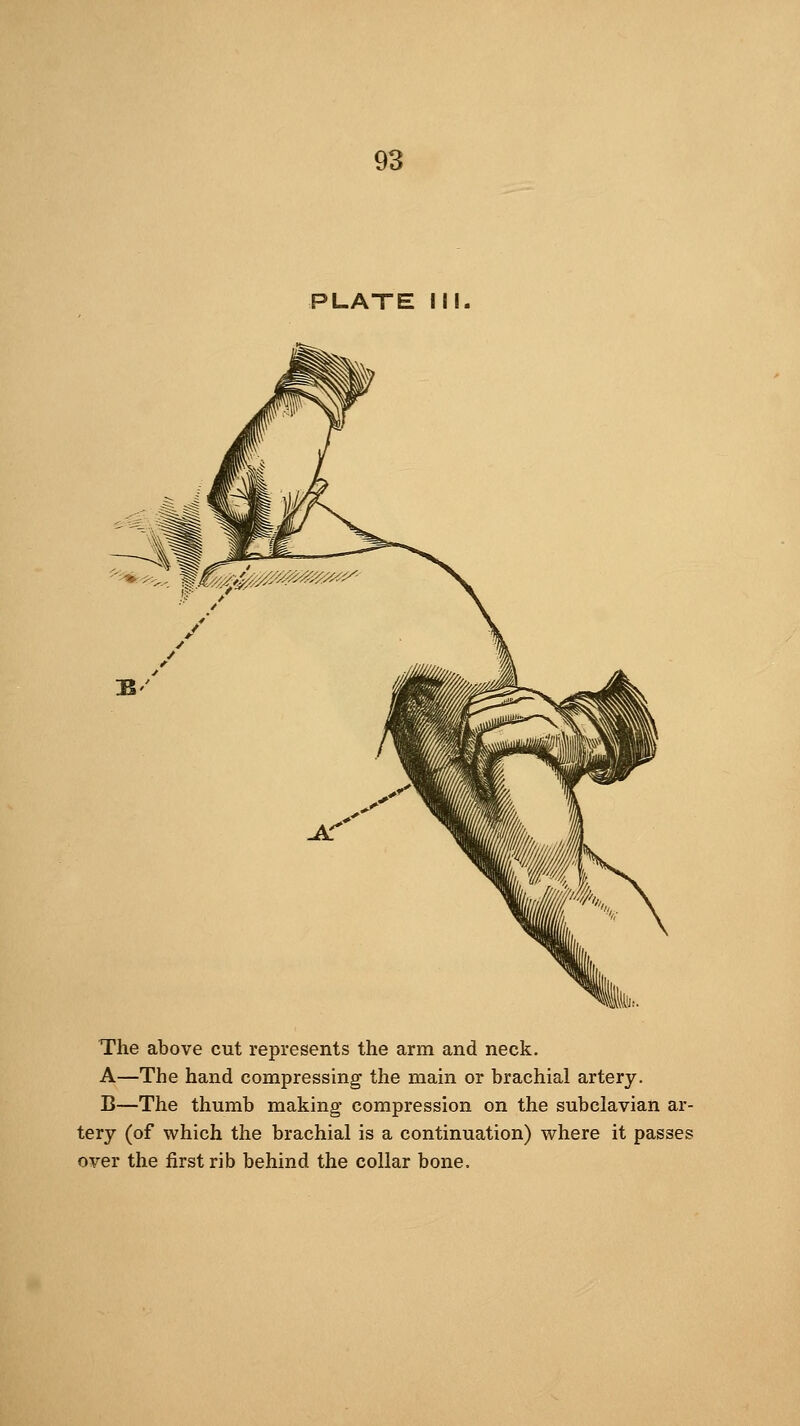 PLATE I The above cut represents the arm and neck, A—The hand compressing the main or brachial artery. B—The thumb making compression on the subclavian ar- tery (of which the brachial is a continuation) where it over the first rib behind the collar bone.