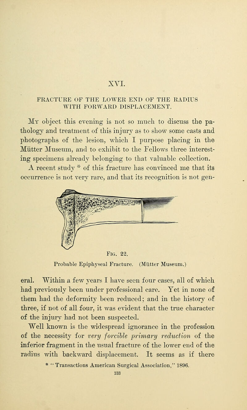 FRACTURE OF THE LOAVER END OF THE RADIUS WITH FORWARD DISPLACEMENT. My object this evening is not so much to discuss the pa- thology and treatment of this injury as to show some casts and photographs of the lesion, which I purpose placing in the Mutter Museum, and to exhibit to the Fellows three interest- ing specimens already belonging to that valuable collection. A recent study * of this fracture has convinced me that its occurrence is not very rare, and that its recognition is not gen- Fig. 22. Probable Epiphyseal Fracture. (Mutter Museum.) eral. Within a few years I have seen four cases, all of which had previously been under professional care. Yet in none of them had the deformity been reduced; and in the history of three, if not of all four, it was evident that the true character of the injury had not been suspected. Well known is the widespread ignorance in the profession of the necessity for very forcible primary reduction of the inferior fragment in the usual fracture of the lower end of the radius with backward displacement. It seems as if there *  Transactions American Surgical Association, 1896.