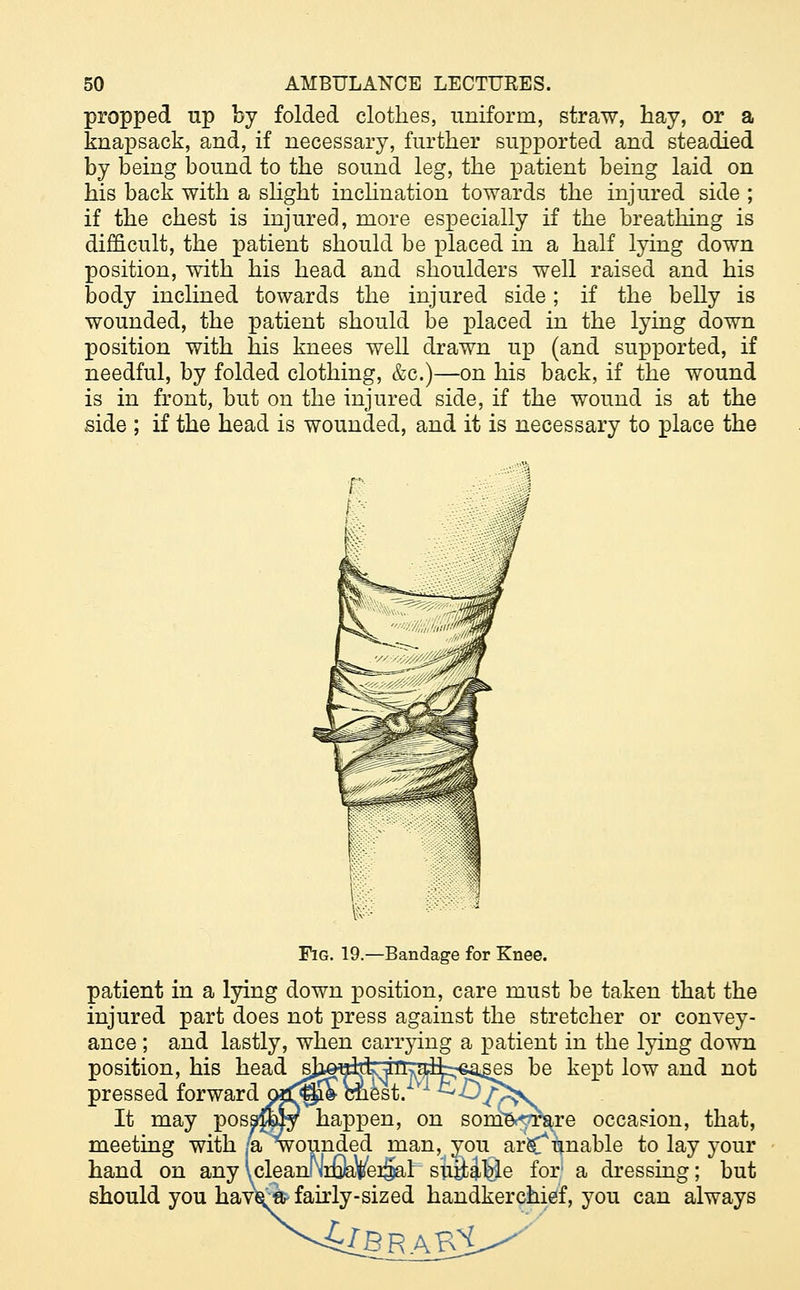 propped up by folded clothes, uniform, straw, hay, or a knapsack, and, if necessary, further supported and steadied by being bound to the sound leg, the patient being laid on his back with a slight inclination towards the injured side ; if the chest is injured, more especially if the breathing is difficult, the patient should be placed in a half lying down position, with his head and shoulders well raised and his body inclined towards the injured side; if the belly is wounded, the patient should be placed in the lying down position with his knees well drawn up (and supported, if needful, by folded clothing, &c.)—on his back, if the wound is in front, but on the injured side, if the wound is at the side ; if the head is wounded, and it is necessary to place the Fig. 19.—Bandage for Knee. patient in a lying down position, care must be taken that the injured part does not press against the stretcher or convey- ance ; and lastly, when carrying a patient in the lying down position, his head ^lorfiWn>aifcrea^es be kept low and not pressed forward p*f^¥ ciest. *^7?^V It may posagiy happen, on sonm^are occasion, that, meeting with k wounded man, you ar^unable to lay your hand on anyIcleanNiflaVerSal suable for* a dressing; but should you navV a- fairly-sized handkerchief, you can always