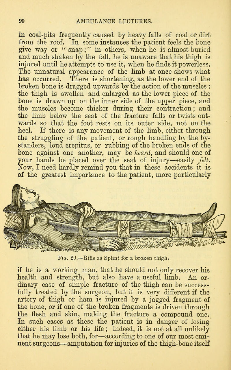 in coal-pits frequently caused by heavy falls of coal or dirt from the roof. In some instances the patient feels the bone give way or snap; in others, when he is almost buried and much shaken by the fall, he is unaware that his thigh is injured until he attempts to use it, when he finds it powerless. The unnatural appearance of the limb at once shows what has occurred. There is shortening, as the lower end of the broken bone is dragged upwards by the action of the muscles ; the thigh is swollen and enlarged as the lower piece of the bone is drawn up on the inner side of the upper piece, and the muscles become thicker during their contraction; and the limb below the seat of the fracture falls or twists out- wards so that the foot rests on its outer side, not on the heel. If there is any movement of the lhnb, either through the struggling of the patient, or rough handling by the by- standers, loud crepitus, or rubbing of the broken ends of the bone against one another, may be heard, and should one of your hands be placed over the seat of injury—easily felt. Now, I need hardly remind you that in these accidents it is of the greatest importance to the patient, more particularly Fig. 29.—RiHe as Splint for a broken thigh. if he is a working man, that he should not only recover his health and strength, but also have a useful limb. An or- dinary case of simple fracture of the thigh can be success- fully treated by the surgeon, but it is very different if the artery of thigh or ham is injured by a jagged fragment of the bone, or if one of the broken fragments is driven through the flesh and skin, making the fracture a compound one. In such cases as these the patient is in danger of losing either his limb or his life ; indeed, it is not at all unlikely that he may lose both, for—according to one of our most emi- nent surgeons—amputation for injuries of the thigh-bone itself