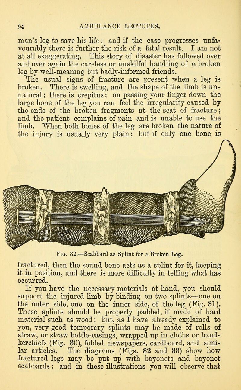 man's leg to save his life; and if the case progresses unfa- vourably there is further the risk of a fatal result. I am not at all exaggerating. This story of disaster has followed over and over again the careless or unskilful handling of a broken leg by well-meaning but badly-informed friends. The usual signs of fracture are present when a leg is broken. There is swelling, and the shape of the limb is un- natural ; there is crepitus; on passing your finger down the large bone of the leg you can feel the irregularity caused by the ends of the broken fragments at the seat of fracture; and the patient complains of pain and is unable to use the lhnb. When both bones of the leg are broken the nature of the injury is usually very plain; but if only one bone is Fig. 32.—Scabbard as Splint for a Broken Leg. fractured, then the sound bone acts as a splint for it, keeping it in position, and there is more difficulty in telling what has occurred. If you have the necessary materials at hand, you should support the injured limb by binding on two splints—one on the outer side, one on the inner side, of the leg (Fig. 31). These splints should be properly padded, if made of hard material such as wood; but, as I have already explained to you, very good temporary splints may be made of rolls of straw, or straw bottle-casings, wrapped up in cloths or hand- kerchiefs (Fig. 30), folded newspapers, cardboard, and simi- lar articles. The diagrams (Figs. 32 and 33) show how fractured legs may be put up with bayonets and bayonet scabbards ; and in these illustrations you will observe that