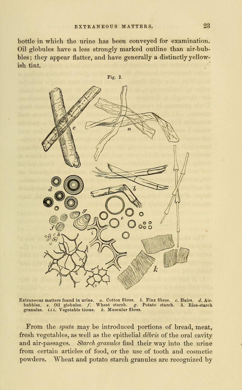bottle in which the urine has been conveyed for examination. Oil globules have a less strongly marked outline than air-bub- bles ; they appear flatter, and have generally a distinctly yellow- ish tint. Fig. 2. Extraneous matters found in urine, a. Cotton fibres, b. Flax fibres, c. Hairs, d. Air- bubbles, e. Oil globules, f. Wheat starch, g. Potato starch, h. Rice-starch granules, iii. Vegetable tissue, k. Muscular fibres. From the sputa may be introduced portions of bread, meat, fresh vegetables, as well as the epithelial debris of the oral cavity and air-passages. Starch granules find their way into the urine from certain articles of food, or the use of tooth and cosmetic powders, Wheat and potato starch granules are recognized by