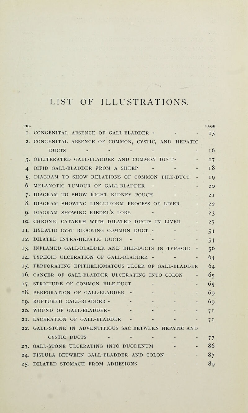 LIST OF ILLUSTRATIONS. FIG. PAGE 1. CONGENITAL ABSENCE OF GALL-BLADDER - - 15 2. CONGENITAL ABSENCE OF COMMON, CYSTIC, AND HEPATIC DUCTS - - - - - 16 3. OBLITERATED GALL-BLADDER AND COMMON DUCT- - 17 4 BIFID GALL-BLADDER FROM A SHEEP - - - 18 5. DIAGRAM TO SHOW RELATIONS OF COMMON BILE-DUCT - 19 6. MELANOTIC TUMOUR OF GALL-BLADDER - - 20 7. DIAGRAM TO SHOW RIGHT KIDNEY POUCH - - 21 8. DIAGRAM SHOWING LINGU1FORM PROCESS OF LIVER - 2 2 9. DIAGRAM SHOWING RIEDEL's LOBE - - 23 10. CHRONIC CATARRH WITH DILATED DUCTS IN LIVER - 27 11. HYDATID CYST BLOCKING COMMON DUCT - - 54 12. DILATED INTRA-HEPATIC DUCTS - - - 54 13. INFLAMED GALL-BLADDER AND BILE-DUCTS IN TYPHOID - 56 14. TYPHOID ULCERATION OF GALL-BLADDER - - - 64 15. PERFORATING EP1THELIOMATOUS ULCER OF GALL-BLADDER 64 16. CANCER OF GALL-BLADDER ULCERATING INTO COLON - 65 17. STRICTURE OF COMMON BILE-DUCT - - 65 18. PERFORATION OF GALL-BLADDER - - - - 69 T9. RUPTURED GALL-BLADDER - - - - - 69 20. WOUND OF GALL-BLADDER- - - - 7* 21. LACERATION OF GALL-BLADDER - - r 71 2 2. GALL-STONE IN ADVENTITIOUS SAC BETWEEN HEPATIC AND CYSTIC DUCTS - - - - 77 23. GALL-STONE ULCERATING INTO DUODENUM - - 86 24. FISTULA BETWEEN GALL-BLADDER AND COLON - 87 25. DILATED STOMACH FROM ADHESIONS - - 89