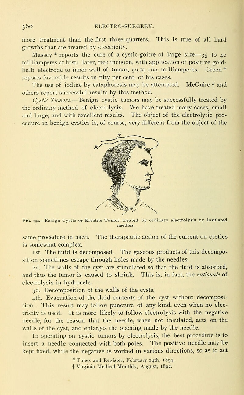 more treatment than the first three-quarters. This is true of all hard growths that are treated by electricity. Massey * reports the cure of a cystic goitre of large size—35 to 40 milliamperes at first; later, free incision, with application of positive gold- bulb electrode to inner wall of tumor, 50 to 100 milliamperes. Green * reports favorable results in fifty per cent, of his cases. The use of iodine by cataphoresis may be attempted. McGuire f and others report successful results by this method. Cystic Tumors.-—Benign cystic tumors may be successfully treated by the ordinary method of electrolysis. We have treated many cases, small and large, and with excellent results. The object of the electrolytic pro- cedure in benign cystics is, of course, very different from the object of the Fig. igo.—Benign Cystic or Erectile Tumor, treated by ordinary electrolysis by insulated needles. same procedure in naevi. The therapeutic action of the current on cystics is somewhat complex. I St. The fluid is decomposed. The gaseous products of this decompo- sition sometimes escape through holes made by the needles. 2d. The walls of the cyst are stimulated so that the fluid is absorbed, and thus the tumor is caused to shrink. This is, in fact, the rationale of electrolysis in hydrocele. 3d. Decomposition of the walls of the cysts. 4th. Evacuation of the fluid contents of the cyst without decomposi- tion. This result may follow puncture of any kind, even when no elec- tricity is used. It is more likely to follow electrolysis with the negative needle, for the reason that the needle, when not insulated, acts on the walls of the cyst, and enlarges the opening made by the needle. In operating on cystic tumors by electrolysis, the best procedure is to insert a needle connected with both poles. The positive needle may be kept fixed, while the negative is worked in various directions, so as to act * Times and Register, February 24th, 1894. f Virginia Medical Monthly, August, 1892.