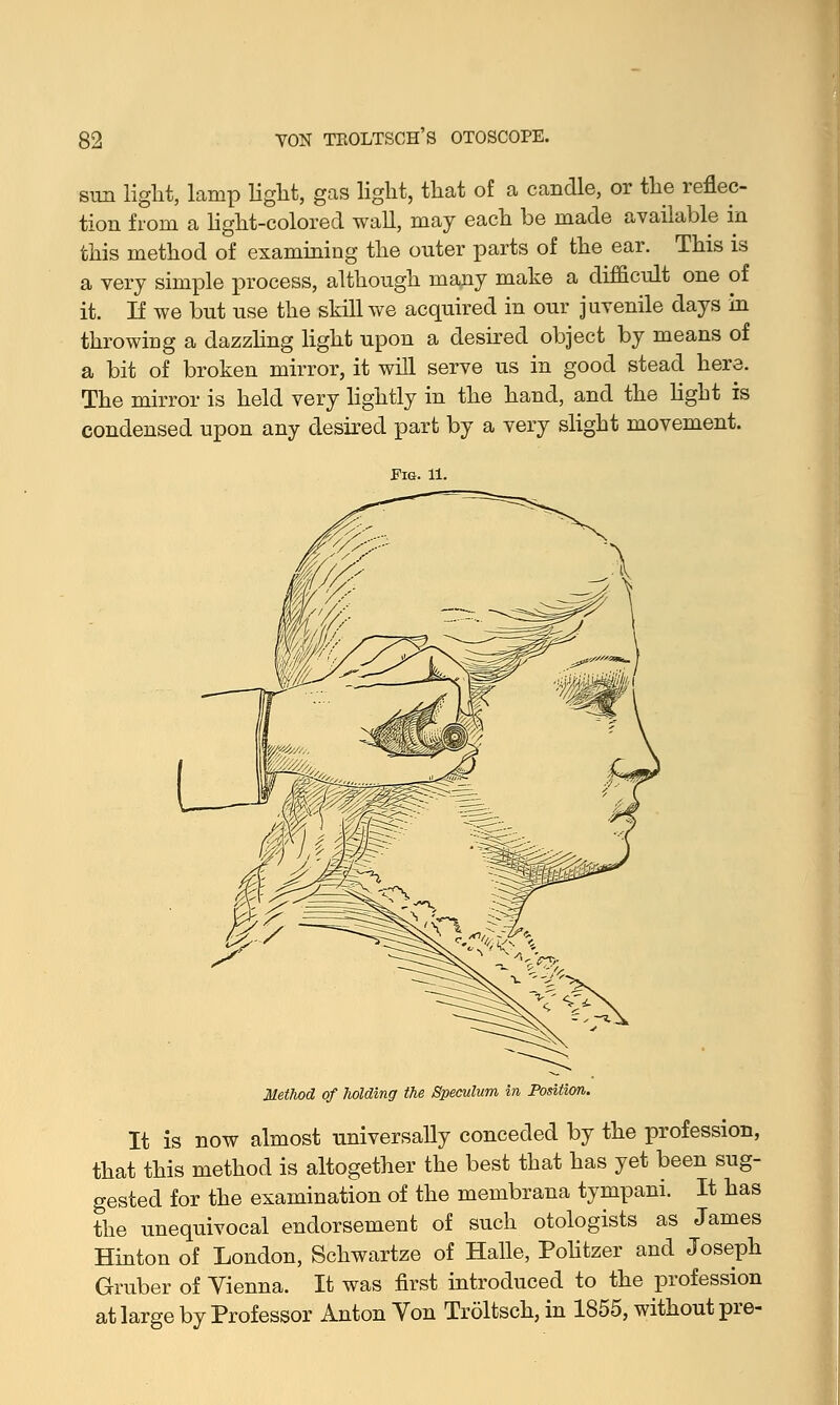 s- YON TEOLTSCH'S OTOSCOPE. sun light, lamp light, gas light, that of a candle, or the reflec- tion from a light-colored wall, may each be made available in this method of examining the outer parts of the ear. This is a very simple process, although many make a difficult one of it. If we but use the skill we acquired in our juvenile days in throwing a dazzling light upon a desired object by means of a bit of broken mirror, it will serve us in good stead here. The mirror is held very lightly in the hand, and the light is condensed upon any desired part by a very slight movement. Method of holding the Speculum in Position. It is now almost universally conceded by the profession, that this method is altogether the best that has yet been sug- gested for the examination of the membrana tympani. It has the unequivocal endorsement of such otologists as James Hinton of London, Schwartze of Halle, Politzer and Joseph Gruber of Vienna. It was first introduced to the profession at large by Professor Anton Von Troltsch, in 1855, without pre-
