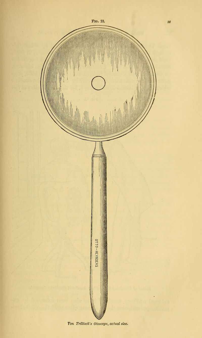 Ton TroltscWs Otoscope, actual size.