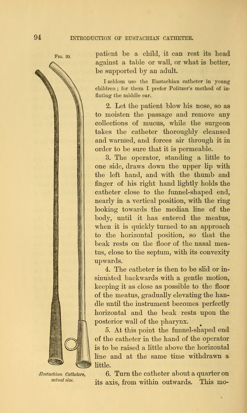 Eustachian Catheters, actual size. patient be a child, it can rest its head against a table or wall, or what is better, be supported by an adult. I seldom use the Eustachian catheter in young children ; for them I prefer Politzer's method of in- flating the middle ear. 2. Let the patient blow his nose, so as to moisten the passage and remove any collections of mucus, while the surgeon takes the catheter thoroughly cleansed and warmed, and forces air through it in order to be sure that it is permeable. 3. The operator, standing a little to one side, draws down the upper lip with the left hand, and with the thumb and finger of his right hand lightly holds the catheter close to the funnel-shaped end, nearly in a vertical position, with the ring looking towards the median line of the body, until it has entered the meatus, when it is quickly turned to an approach to the horizontal position, so that the beak rests on the floor of the nasal mea- tus, close to the septum, with its convexity upwards. 4. The catheter is then to be slid or in- sinuated backwards with a gentle motion, keeping it as close as possible to the floor of the meatus, gradually elevating the han- dle until the instrument becomes perfectly horizontal and the beak rests upon the posterior wall of the pharynx. 5. At this point the funnel-shaped end of the catheter in the hand of the operator is to be raised a little above the horizontal line and at the same time withdrawn a little. 6. Turn the catheter about a quarter on its axis, from within outwards. This mo-