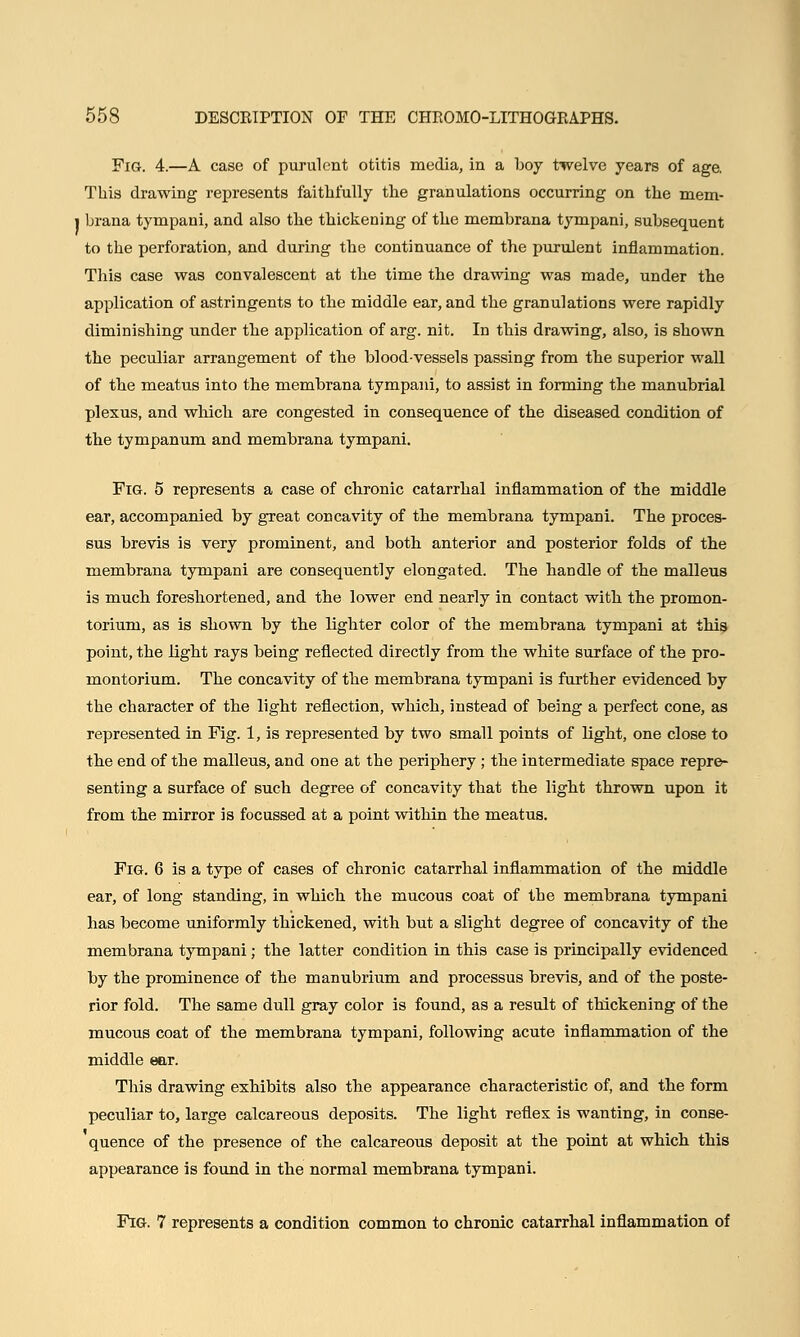 Fig. 4.—A case of purulent otitis media, in a boy twelve years of age. This drawing represents faithfully the granulations occurring on the mem- i brana tympani, and also the thickening of the membrana tympani, subsequent to the perforation, and during the continuance of the purulent inflammation. This case was convalescent at the time the drawing was made, under the application of astringents to the middle ear, and the granulations were rapidly diminishing under the application of arg. nit. In this drawing, also, is shown the peculiar arrangement of the bloodvessels passing from the superior wall of the meatus into the membrana tympani, to assist in forming the manubrial plexus, and which are congested in consequence of the diseased condition of the tympanum and membrana tympani. Fig. 5 represents a case of chronic catarrhal inflammation of the middle ear, accompanied by great concavity of the membrana tympani. The proces- sus brevis is very prominent, and both anterior and posterior folds of the membrana tympani are consequently elongated. The handle of the malleus is much foreshortened, and the lower end nearly in contact with the promon- torium, as is shown by the lighter color of the membrana tympani at this point, the light rays being reflected directly from the white surface of the pro- montorium. The concavity of the membrana tympani is further evidenced by the character of the light reflection, which, instead of being a perfect cone, as represented in Fig. 1, is represented by two small points of light, one close to the end of the malleus, and one at the periphery ; the intermediate space repre- senting a surface of such degree of concavity that the light thrown upon it from the mirror is focussed at a point within the meatus. Fig. 6 is a type of cases of chronic catarrhal inflammation of the middle ear, of long standing, in which the mucous coat of the membrana tympani has become uniformly thickened, with but a slight degree of concavity of the membrana tympani; the latter condition in this case is principally evidenced by the prominence of the manubrium and processus brevis, and of the poste- rior fold. The same dull gray color is found, as a result of thickening of the mucous coat of the membrana tympani, following acute inflammation of the middle ear. This drawing exhibits also the appearance characteristic of, and the form peculiar to, large calcareous deposits. The light reflex is wanting, in conse- quence of the presence of the calcareous deposit at the point at which this appearance is found in the normal membrana tympani. Fig. 7 represents a condition common to chronic catarrhal inflammation of