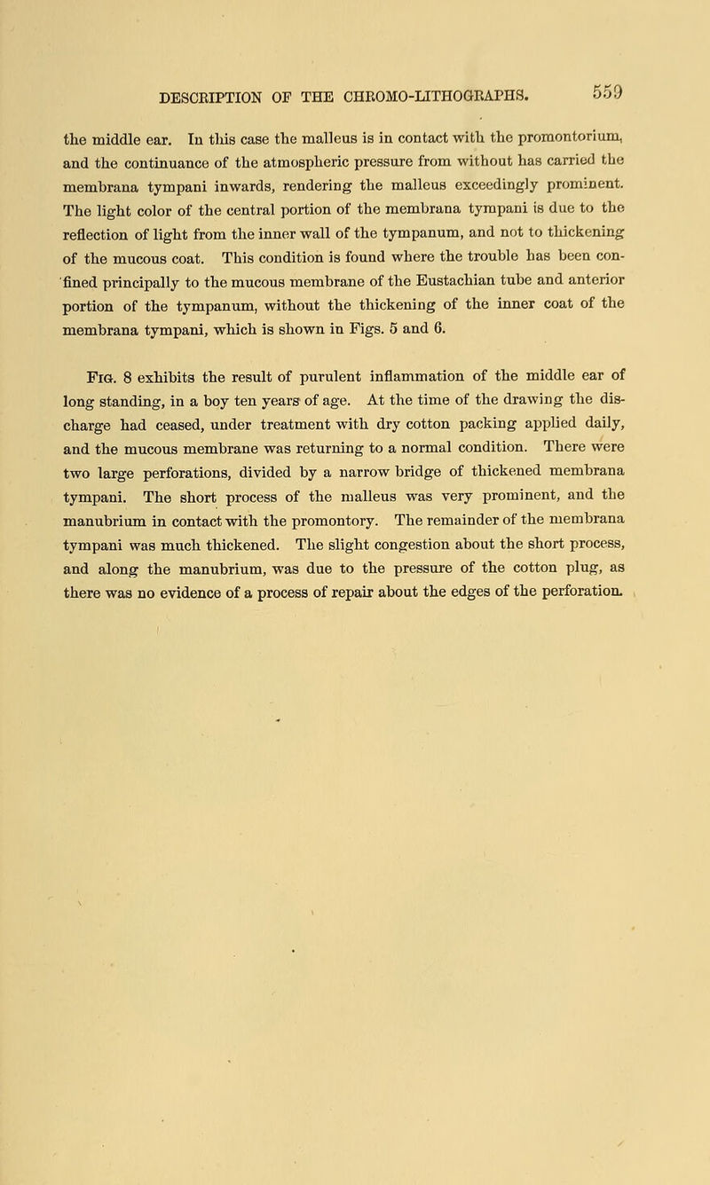 the middle ear. In this case the malleus is in contact with the promontorium, and the continuance of the atmospheric pressure from without has carried the membrana tympani inwards, rendering the malleus exceedingly prominent. The light color of the central portion of the membrana tympani is due to the reflection of light from the inner wall of the tympanum, and not to thickening of the mucous coat. This condition is found where the trouble has been con- fined principally to the mucous membrane of the Eustachian tube and anterior portion of the tympanum, without the thickening of the inner coat of the membrana tympani, which is shown in Figs. 5 and 6. Fig. 8 exhibits the result of purulent inflammation of the middle ear of long standing, in a boy ten years of age. At the time of the drawing the dis- charge had ceased, under treatment with dry cotton packing applied daily, and the mucous membrane was returning to a normal condition. There were two large perforations, divided by a narrow bridge of thickened membrana tympani. The short process of the malleus was very prominent, and the manubrium in contact with the promontory. The remainder of the membrana tympani was much thickened. The slight congestion about the short process, and along the manubrium, was due to the pressure of the cotton plug, as there was no evidence of a process of repair about the edges of the perforation.