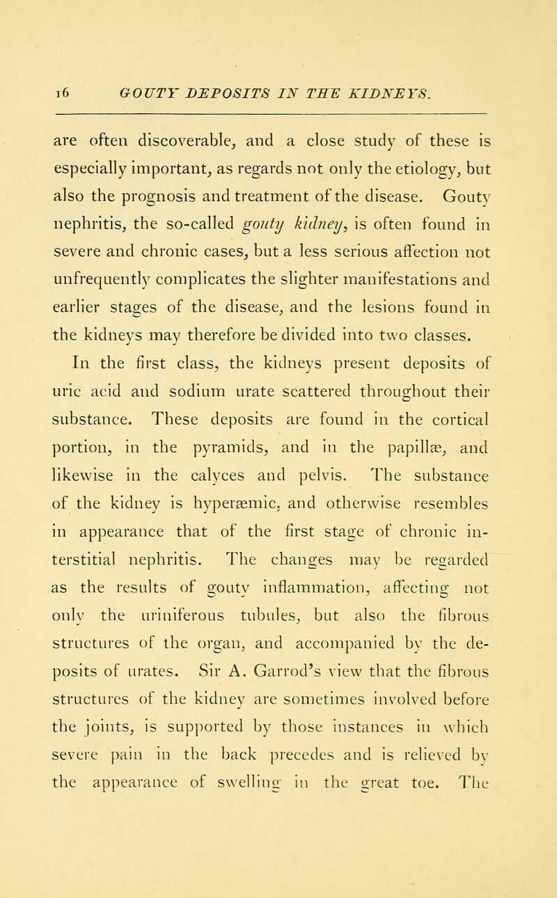 are often discoverable, and a close study of these is especially important, as regards not only the etiology, but also the prognosis and treatment of the disease. Goutv nephritis, the so-called gouty kidney, is often found in severe and chronic cases, but a less serious affection not unfrequently complicates the slighter manifestations and earlier stages of the disease, and the lesions found in the kidneys may therefore be divided into two classes. In the first class, the kidneys present deposits of uric acid and sodium urate scattered throughout their substance. These deposits are found in the cortical portion, in the pyramids, and in the papillae, and likewise in the calyces and pelvis. The substance of the kidney is hyperaemic. and otherwise resembles in appearance that of the first stage of chronic in- terstitial nephritis. The changes may be regarded as the results of s;outv inflammation, affecting; not only the uriniferous tubules, but also the fibrous structures of the organ, and accompanied by the de- posits of urates. Sir A. Garrod's view that the fibrous structures of the kidney are sometimes involved before the joints, is supported by those instances in which severe pain in the back precedes and is relieved bv the appearance of swelling in the great toe. The