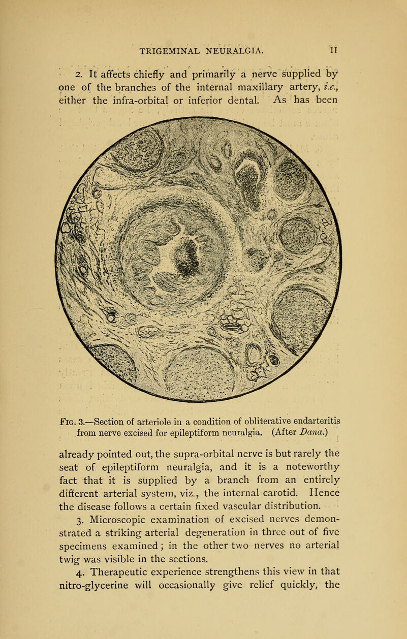 - 2. It affects chiefly and primarily a nerve supplied by one of the branches of the internal maxillary artery, i.e., either the infra-orbital or inferior dental. As has been Fig. 3.—Section of arteriole in a condition of obliterative endarteritis from nerve excised for epileptiform neuralgia. (After Dana.) already pointed out, the supra-orbital nerve is but rarely the seat of epileptiform neuralgia, and it is a noteworthy fact that it is supplied by a branch from an entirely different arterial system, viz., the internal carotid. Hence the disease follows a certain fixed vascular distribution. 3. Microscopic examination of excised nerves demon- strated a striking arterial degeneration in three out of five specimens examined; in the other two nerves no arterial twig was visible in the sections. 4. Therapeutic experience strengthens this view in that nitro-glycerine will occasionally give relief quickly, the