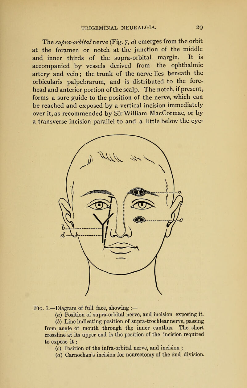 The supra-orbitalnevve (Fig. 7, a) emerges from the orbit at the foramen or notch at the junction of the middle and inner thirds of the supra-orbital margin. It is accompanied by vessels derived from the ophthalmic artery and vein; the trunk of the nerve lies beneath the orbicularis palpebrarum, and is distributed to the fore- head and anterior portion of the scalp. The notch, if present, forms a sure guide to the position of the nerve, which can be reached and exposed by a vertical incision immediately over it, as recommended by Sir William MacCormac, or by a transverse incision parallel to and a little below the eye- FiG. v.—Diagram of full face, showing :— {a) Position of supra-orbital nerve, and incision exposing it. (6) Line indicating position of supra-trochlear nerve, passing from angle of mouth through, the inner canthus. The short crossline at its upper end is the position of the incision required to expose it; (c) Position of the infra-orbital nerve, and incision ; {d) Carnochan's incision for neurectomy of the 2nd division.