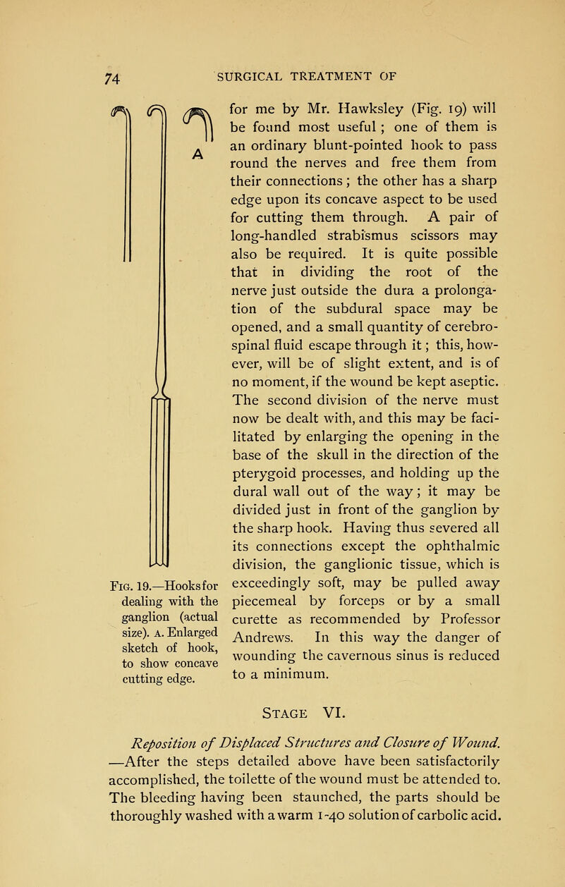 ^ Fig. 19.—Hooksfor dealing with the ganglion (actual size). A. Enlarged sketch of hook, to show concave cutting edge. for me by Mr. Hawksley (Fig. 19) will be found most useful; one of them is an ordinary blunt-pointed hook to pass round the nerves and free them from their connections; the other has a sharp edge upon its concave aspect to be used for cutting them through. A pair of long-handled strabismus scissors may also be required. It is quite possible that in dividing the root of the nerve just outside the dura a prolonga- tion of the subdural space may be opened, and a small quantity of cerebro- spinal fluid escape through it; this, how- ever, will be of slight extent, and is of no moment, if the wound be kept aseptic. The second division of the nerve must now be dealt with, and this may be faci- litated by enlarging the opening in the base of the skull in the direction of the pterygoid processes, and holding up the dural wall out of the way; it may be divided just in front of the ganglion by the sharp hook. Having thus severed all its connections except the ophthalmic division, the ganglionic tissue, which is exceedingly soft, may be pulled away piecemeal by forceps or by a small curette as recommended by Professor Andrews. In this way the danger of wounding the cavernous sinus is reduced to a minimum. Stage VI. Reposition of Displaced Structures and Closure of Wound, —After the steps detailed above have been satisfactorily accomplished, the toilette of the wound must be attended to. The bleeding having been staunched, the parts should be thoroughly washed with a warm 1-40 solution of carbolic acid.