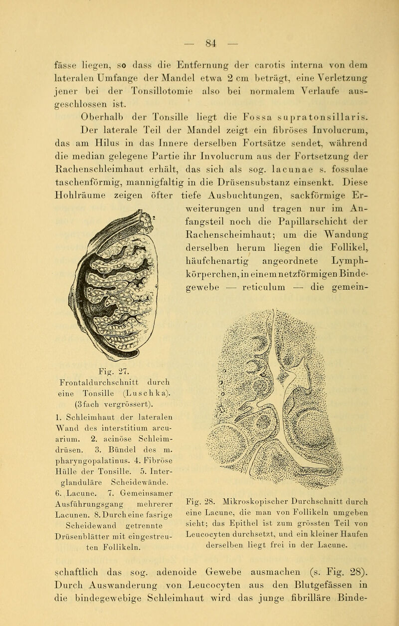 fasse liegen, so dass die Entfernung der carotis interna von dem lateralen Umfange der Mandel etwa 2 cm beträgt, eine Verletzung jener bei der Tonsillotomie also bei normalem Verlaufe aus- geschlossen ist. Oberhalb der Tonsille liegt die Fossa supratonsillaris. Der laterale Teil der Mandel zeigt ein fibröses Involucrum, das am Hilus in das Innere derselben Fortsätze sendet, während die median gelegene Partie ihr Involucrum aus der Fortsetzung der Rachenschleimhaut erhält, das sich als sog. lacunae s. fossulae taschenförmig, mannigfaltig in die Drüsensubstanz einsenkt. Diese Hohlräume zeigen öfter tiefe Ausbuchtungen, sackförmige Er- weiterungen und tragen nur im An- fangsteil noch die Papillarschicht der Rachenscheimhaut; um die Wandung derselben herum liegen die Follikel, häufchenartig angeordnete Lyniph- körperchen, in einemnetzförmigen Binde- gewebe — reticulum —■ die gemein- Fig. 27._ Frontaldurchschnitt durch eine Tonsille (Luschka). (3 fach vergrössert). 1. Schleimhaut der lateralen Wand des interstitium arcu- arium. 2. acinöse Schleim- drüsen. 3. Bündel des m. pharyngopalatinus. 4. Fibröse Hülle der Tonsille. 5. Inter- glanduläre Scheidewände. 6. Lacune. 7. Gemeinsamer Ausführungsgang mehrerer Lacunen. 8. Durch eine fasrige Scheidewand getrennte Drüsenblätter mit eingestreu- ten Follikeln. Fig. 28. Mikroskopischer Durchschnitt durch eine Lacune, die man von Follikeln umgeben sieht; das Epithel ist zum grössten Teil von Leucocyten durchsetzt, und ein kleiner Haufen derselben liegt frei in der Lacune. schaftlich das sog. adenoide Gewebe ausmachen (s. Fig. 28). Durch Auswanderung von Leucocyten aus den Blutgefässen in die bindegewebige Schleimhaut wird das junge fibrilläre Binde-