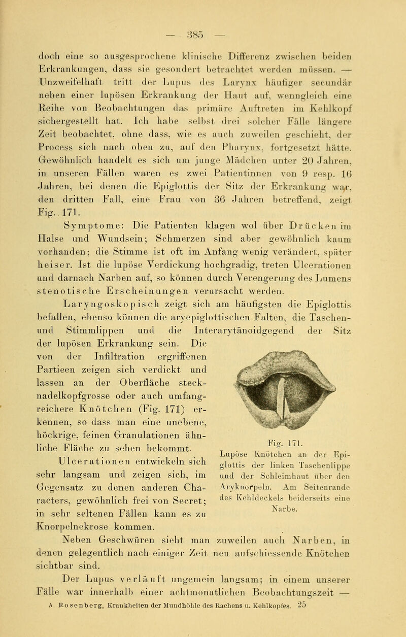 doch eine so ausgesprochene klinische Differenz zwischen beides Erkrankungen, dass sie gesondert betrachtet werden müssen. — Unzweifelhaft tritt der Lupus des Larynx häufiger secundär neben einer lupösen Erkrankung Aer Haut auf, wenngleich eine Reihe von Beobachtungen das primäre Auftreten im Kehlkopf sichergestellt hat. Ich habe selbst drei solcher Fälle längere Zeit beobachtet, ohne dass, wie es auch zuweilen geschieht, der Process sich nach oben zu, auf den Pharynx, fortgesetzt hätte. Gewöhnlich handelt es sich um junge Mädchen unter 20 Jahren, in unseren Fällen waren es zwei Patientinnen von 9 resp. 16 Jahren, bei denen die Epiglottis der Sitz der Erkrankung war, den dritten Fall, eine Frau von 36 Jahren betreffend, zeigt Fig. 171. Symptome: Die Patienten klagen wol über Drücken im Halse und Wundsein; Schmerzen sind aber gewöhnlich kaum vorhanden; die Stimme ist oft im Anfang wenig verändert, später heiser. Ist die lupöse Verdickung hochgradig, treten Ulcerationen und darnach Narben auf, so können durch Verengerung des Lumens stenotische Erscheinungen verursacht werden. Laryngoskopisch zeigt sich am häufigsten die Epiglottis befallen, ebenso können die aryepiglottischen Falten, die Taschen- und Stimmlippen und die Interarytänoidgegend der Sitz der lupösen Erkrankung sein. Die von der Infiltration ergriffenen Partieen zeigen sich verdickt und lassen an der Oberfläche steck- nadelkopfgrosse oder auch umfang- reichere Knötchen (Fig. 171) er- kennen, so dass man eine unebene, höckrige, feinen Granulationen ähn- liche Fläche zu sehen bekommt. Ulcerationen entwickeln sich sehr langsam und zeigen sich, im Gegensatz zu denen anderen Cha- racters, gewöhnlich frei von Secret; in sehr seltenen Fällen kann es zu Knorpelnekrose kommen. Neben Geschwüren sieht man zuweilen auch Narben, in denen gelegentlich nach einiger Zeit neu aufschiessende Knötchen sichtbar sind. Der Lupus verläuft ungemein langsam; in einem unserer Fälle war innerhalb einer achtmonatlichen Beobachtungszeit — A Rosenberg, Krankheiten der Mundhöhle des Rachens u. Kehlkopfes. 25 Fig. 171. Lupöse Knötchen an der Epi- glottis der linken Taschenlippe und der Schleimhaut über den Aryknorpeln. Am Seitenrande des Kehldeckels beiderseits eine Narbe.