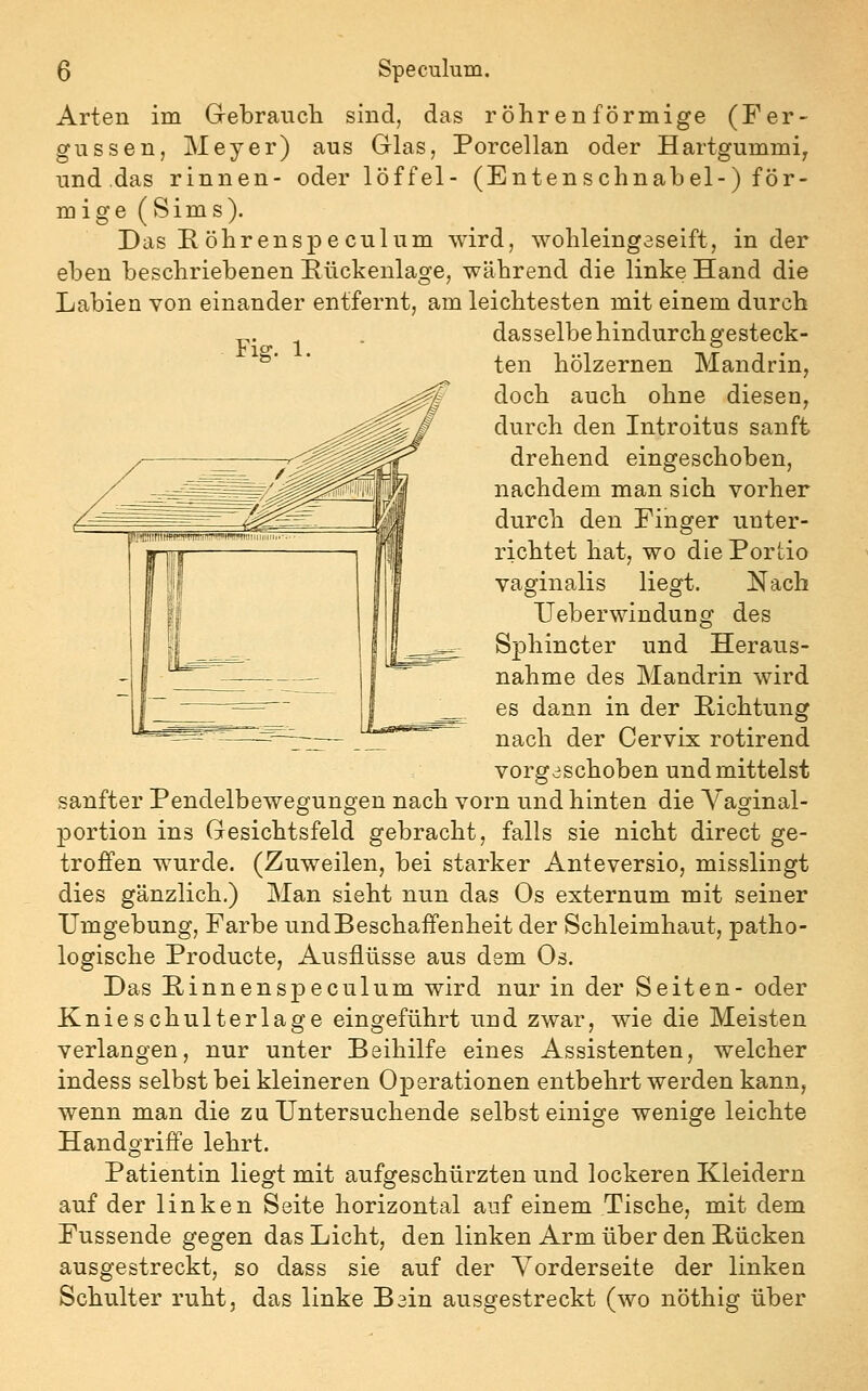 Fig. Arten im Gebrauch sind, das röhrenförmige (Fer- gussen, Meyer) aus Glas, Porcellan oder Hartgummi^ und das rinnen- oder löffel- (Entenschnahel-) för- mige (Sims). Das RÖhrenspeculum wird, wohleingaseift, in der eben beschriebenen Bückenlage, während die linke Hand die Labien von einander entfernt, am leichtesten mit einem durch dasselbe hindurch gesteck- ten hölzernen Mandrin, doch auch ohne diesen, durch den Introitus sanft drehend eingeschoben, nachdem man sich vorher durch den Finger unter- richtet hat, wo die Portio vaginalis liegt. Nach TJeberwindung des Sphincter und Heraus- nahme des Mandrin wird es dann in der Richtung nach der Oervix rotirend vorgeschoben und mittelst sanfter Pendelbewegungen nach vorn und hinten die Vaginal- portion ins Gesichtsfeld gebracht, falls sie nicht direct ge- troffen wurde. (Zuweilen, bei starker Anteversio, misslingt dies gänzlich.) Man sieht nun das Os externum mit seiner Umgebung, Farbe und Beschaffenheit der Schleimhaut, patho- logische Producte, Ausflüsse aus dem Os. Das Pinnenspeculum wird nur in der Seiten- oder Knieschulterlage eingeführt und zwar, wie die Meisten verlangen, nur unter Beihilfe eines Assistenten, welcher indess selbst bei kleineren Operationen entbehrt werden kann, wenn man die zu Untersuchende selbst einige wenige leichte Handgriffe lehrt. Patientin liegt mit aufgeschürzten und lockeren Kleidern auf der linken Seite horizontal auf einem Tische, mit dem Fussende gegen das Licht, den linken Arm über den Bücken ausgestreckt, so dass sie auf der Vorderseite der linken Schulter ruht, das linke Bain ausgestreckt (wo nöthig über