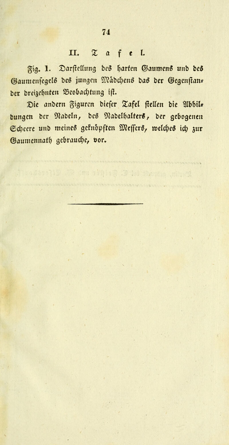 74 IL Z et f c I. gig, 1. DarfMIung be3 Warfen ©aumenS unb be$ (SJaumenfegelS beS jnngett SftabdjenS baS ber ©egenflan* ber brennten Beobachtung t(f. Die anbern giguren biefer £afel jMen bic SlbbiU bungen bcr Nabeln, beä 9?abelbalfer$, ber gebogenen ©cfyeere unb meinet gefci&pffen Keffers, roelcfteö icfy jnr ©aumennatb gebrauche, &ot\