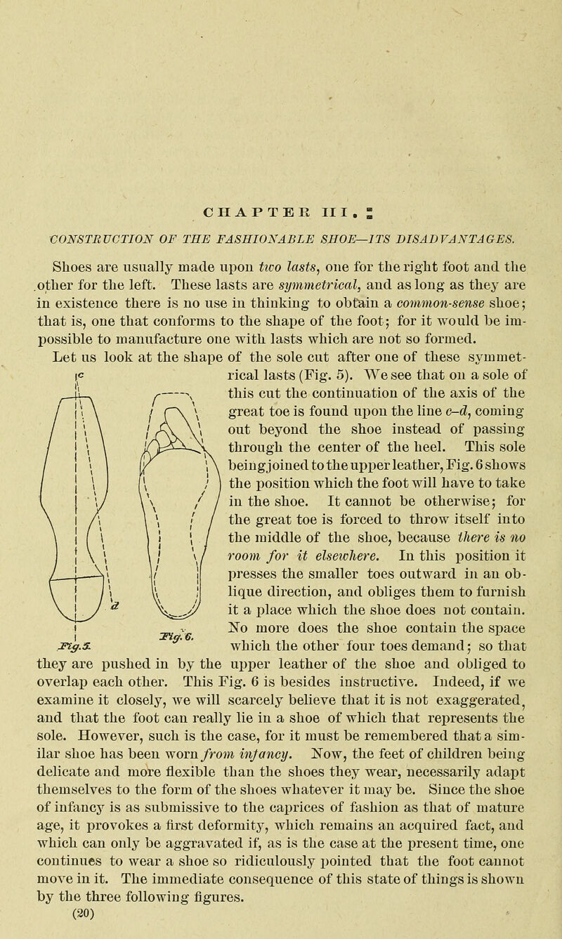 CONSTRUCTION OF THE FASHIONABLE SHOE—ITS DISADVANTAGES. Shoes are usually made upon two lasts, one for the right foot and the .other for the left. These lasts are symmetrical, and as long as they are in existence there is no use in thinking to obtain a common-sense shoe; that is, one that conforms to the shape of the foot; for it would be im- possible to manufacture one with lasts which are not so formed. Let us look at the shape of the sole cut after one of these symmet- rical lasts (Fig. 5). We see that on a sole of this cut the continuation of the axis of the great toe is found upon the line c-d, coming- out beyond the shoe instead of passing through the center of the heel. This sole being joined to the upper leather, Fig. 6 shows the position which the foot will have to take in the shoe. It cannot be otherwise; for the great toe is forced to throw itself into the middle of the shoe, because there is no room for it elsewhere. In this position it presses the smaller toes outward in an ob- lique direction, and obliges them to furnish it a place which the shoe does not contain. No more does the shoe contain the space which the other four toes demand; so that they are pushed in by the ui3per leather of the shoe and obliged to overlap each other. This Fig. 6 is besides instructive. Indeed, if we examine it closely, we will scarcely believe that it is not exaggerated^ and that the foot can really lie in a shoe of which that represents the sole. However, such is the case, for it must be remembered that a sim- ilar shoe has been worn from injancy. Now, the feet of children being delicate and more flexible than the shoes they wear, necessarily adapt themselves to the form of the shoes whatever it may be. Since the shoe of infancj^ is as submissive to the caprices of fashion as that of mature age, it provokes a first deformity, which remains an acquired fact, and which can only be aggravated if, as is the case at the present time, one continues to wear a shoe so ridiculously pointed that the foot cannot move in it. The immediate consequence of this state of things is shown by the three following figures. ;Fis,.s. mff.6.