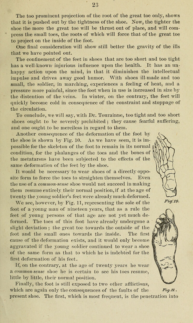 The too prominent projection of the root of the great toe only, shows that it is pushed out by the tightness of the shoe. Now, the tighter the shoe the more the great toe will be thrust out of place, and will com- press the small toes, the roots of which will force that of the great toe to project on the inside of the foot. One final consideration will show still better the gravity of the ills that we have pointed out. The confinement of the feet in shoes that are too short and too tight has a well-known injurious influence upon the health. It has an un- happy action upon the mind, in that it diminishes the intellectual impulse and drives away good humor. With shoes ill-made and too small, the soldier, in marching, experiences a feeling of heat, and a pressure more painful, since the foot when, in use is increased in size by the distention of the veins. In winter, on the contrary, the feet will quickly become cold in consequence of the constraint and stoppage of the circulation. To conclude, we will say, with Dr. Tourainne, too tight and too short shoes ought to be severely prohibited; they cause fearful suffering, and one ought to be merciless in regard to them. Another consequence of the deformation of the foot by the shoe is shown by Fig. 10. As we have seen, it is im- possible for the skeleton of the foot to remain in its normal condition, for the phalanges of the toes and the bones of the metatarsus have been subjected to the effects of the same deformation of the feet by the shoe. It would be necessary to wear shoes of a directly oppo- site form to force the toes to straighten themselves. Even the use of a common-sense shoe would not succeed in making them resume entirely their normal position,if at the age of twenty the young soldier's feet were already much deformed. We see, however, by Fig. 11, representing the sole of the foot of a young man of nineteen years, that as a rule the feet of young persons of that age are not yet much de- formed. The toes of this foot have already undergone a slight deviation ; the great toe towards the outside of the foot and the small ones towards the inside. The first cause of the deformation exists, and it would only become aggravated if the young soldier continued to wear a shoe of the same form as that to which he is indebted for the first deformation of his feet. If, on the contrary, at the age of twenty years he wear a common-sense shoe he is certain to see his toes resume, little by little, their normal position. Finally, the foot is still exposed to two other afflictions, which are again only the consequences of the faults of the i^^-.^z. present shoe. The first, wliich is most frequent, is the penetration into Ficf.lQ.