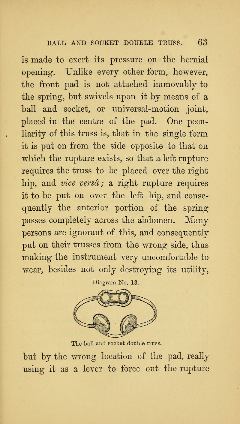 is made to exert its pressure on the hernial opening. Unlike every other form, however, the front pad is not attached immovably to the spring, but swivels npon it by means of a ball and socket, or universal-motion joint, placed in the centre of the pad. One pecu- liarity of this truss is, that in the single form it is put on from the side opposite to that on which the rupture exists, so that a left rupture requires the truss to be placed over the right hip, and vice versa; a right rupture requires it to be put on over the left hip, and conse- quently the anterior portion of the spring passes completely across the abdomen. Many persons are ignorant of this, and consequently put on their trusses from the wrong side, thus making the instrument very uncomfortable to wear, besides not only destroying its utility, Diagram No. 13. The ball and socket double truss. but by the wrong location of the pad, really using it as a lever to force out the rupture