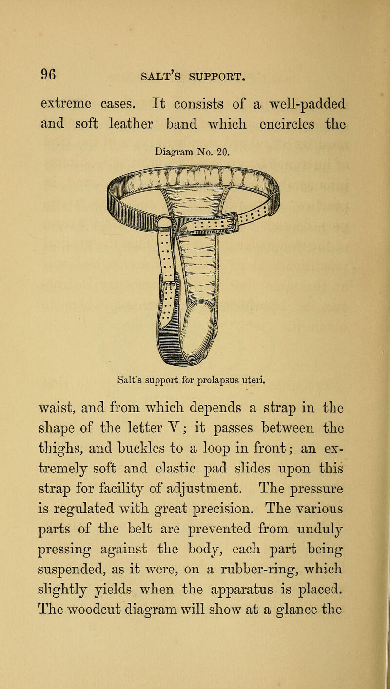 90 SALT S SUPPORT. extreme cases. It consists of a well-padded and soft leather band which encircles the Diagram No. 20. Salt's support for prolapsus uteri. waist, and from which depends a strap in the shape of the letter V; it passes between the thighs, and buckles to a loop in front; an ex- tremely soft and elastic pad slides npon this strap for facility of adjustment. The pressure is regulated with great precision. The various parts of the belt are prevented from unduly pressing against the body, each part being suspended, as it were, on a rubber-ring, which slightly yields when the apparatus is placed. The woodcut diagram will show at a glance the