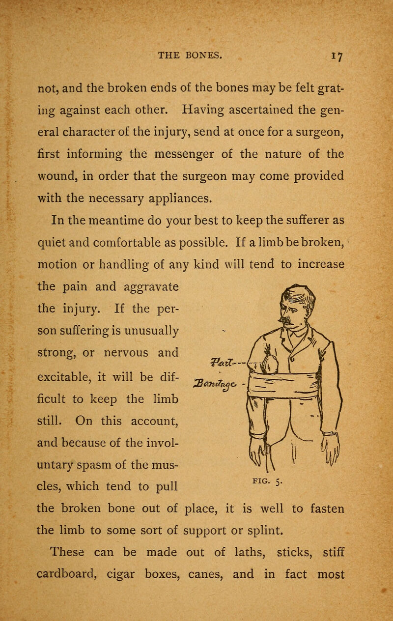 not, and the broken ends of the bones maybe felt grat- ing against each other. Having ascertained the gen- eral character of the injury, send at once for a surgeon, first informing the messenger of the nature of the wound, in order that the surgeon may come provided with the necessary appliances. In the meantime do your best to keep the sufferer as quiet and comfortable as possible. If a limb be broken, motion or handling of any kind will tend to increase the pain and aggravate the injury. If the per- son suffering is unusually strong, or nervous and excitable, it will be dif- ficult to keep the limb still. On this account, and because of the invol- untary spasm of the mus- cles, which tend to pull the broken bone out of place, it is well to fasten the limb to some sort of support or splint. These can be made out of laths, sticks, stiff cardboard, cigar boxes, canes, and in fact most «**--&/ ZB<?ntfcujc> \ ;—