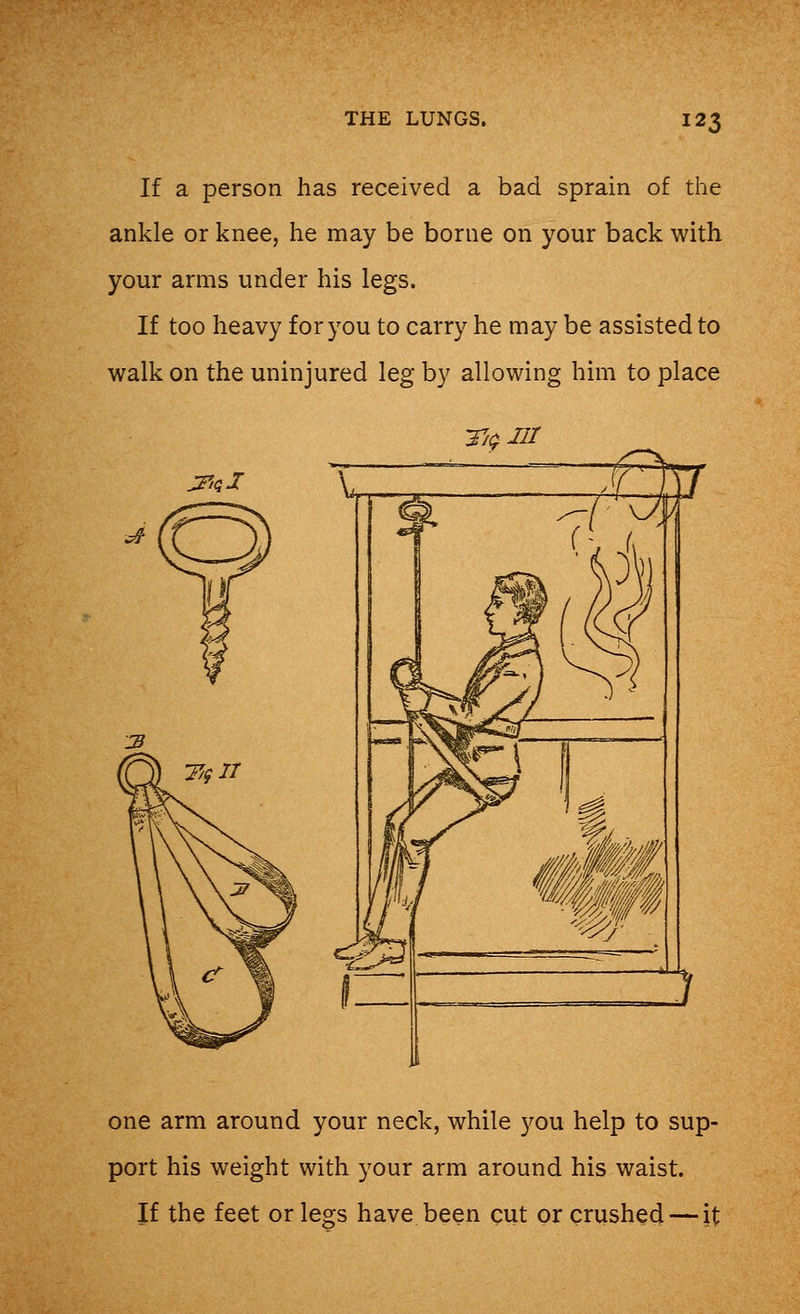 If a person has received a bad sprain of the ankle or knee, he may be borne on your back with your arms under his legs. If too heavy for you to carry he may be assisted to walk on the uninjured leg by allowing him to place Ti$W one arm around your neck, while you help to sup- port his weight with your arm around his waist. If the feet or legs have been cut or crushed — it