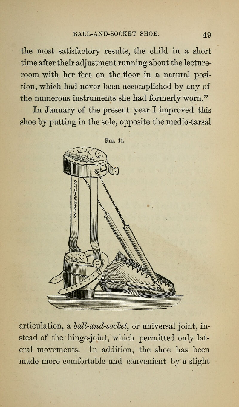 the most satisfactory results, the child in a short time after their adjustment running about the lecture- room with her feet on the floor in a natural posi- tion, which had never been accomplished by any of the numerous instruments she had formerly worn. In January of the present year I improved this shoe by putting in the sole, opposite the medio-tarsal Fia. 11. articulation, a lall-and-soclcet, or universal joint, in- stead of the hinge-joint, which permitted only lat- eral movements. In addition, the shoe has been made more comfortable and convenient by a slight