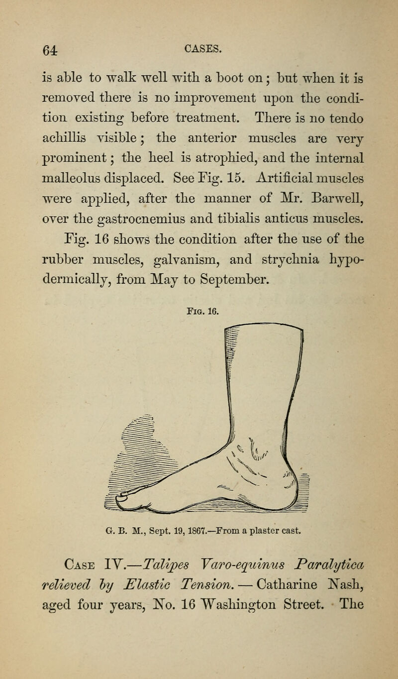 is able to walk well with a boot on; but when it is removed there is no improvement upon the condi- tion existing before treatment. There is no tendo achillis visible; the anterior muscles are very prominent; the heel is atrophied, and the internal malleolus displaced. See Fig. 15. Artificial muscles were applied, after the manner of Mr. Barwell, over the gastrocnemius and tibialis anticus muscles. Fig. 16 shows the condition after the use of the rubber muscles, galvanism, and strychnia hypo- dermically, from May to September. Fig. 16. G. B. M,, Sept. 19,1867.—From a plaster cast. Case IY.—Talipes Varo-equinus Paralytica relieved hy Elastic Tension. — Catharine IS^ash, aged four years, ITo. 16 Washington Street. The