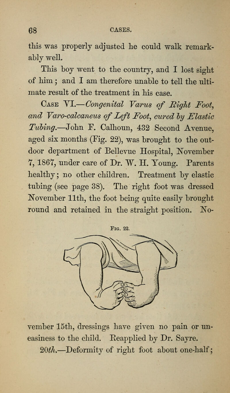 this was properly adjusted lie could walk remark- ably well. This boy went to the country, and I lost sight of him ; and I am therefore unable to tell the ulti- mate result of the treatment in his case. Case YI.—Congenital Varus of Right Foot, and Yaro-calcaneus of Left Foot, cured ly Elastic Tubing.—John F. Calhoun, 432 Second Avenue, aged six months (Fig. 22), was brought to the out- door department of Bellevue Hospital, N'ovember 7, 1867, under care of Dr. W. H. Young. Parents healthy; no other children. Treatment by elastic tubing (see page 38). The right foot was dressed [N'ovember 11th, the foot being quite easily brought round and retained in the straight position. ]^o- FiG. 22. vember 15th, dressings have given no pain or un- easiness to the child. Reapplied by Dr. Sayre. 20^A.—Deformity of right foot about one-half;