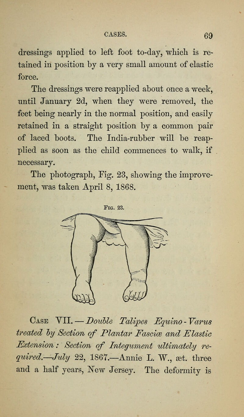 dressings applied to left foot to-day, wHcli is re» tained in position by a very small amount of elastic force. The dressings were reapplied about once a week, until January 2d, when they were removed, tbe feet being nearly in the normal position, and easily retained in a straight position by a common pair of laced boots. The India-rubber will be reap- plied as soon as the child commences to walk, if necessary. The photograph. Fig. 23, showing the improve- ment, was taken April 8, 1868. Fig. 23. Case YII. — Doitble Talijpes Equino-Varus treated hy Section of Plantar Fascim and JSlastic Extension: Section of Integument ultimately re- quired.—July 22, 1867.—Annie L. W., set. three and a half years, I^^ew Jersey. The deformity is