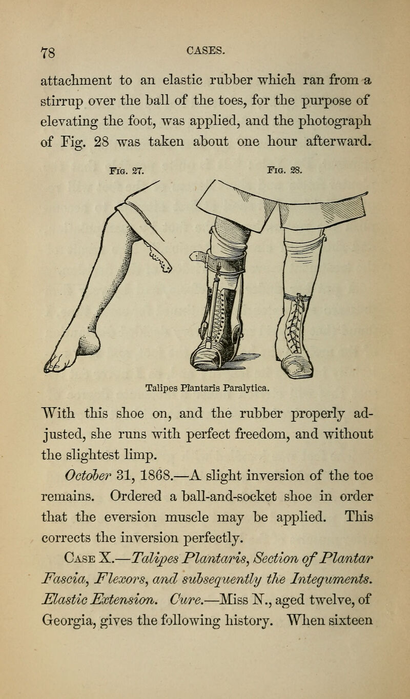 attacliment to an elastic rubber whicli ran from a stirrup over the ball of the toes, for the purpose of elevating the foot, was applied, and the photograph of rig. 28 was taken about one hour afterward. Fig. 27. Fig. 28. Talipes PlaBtaris Paralytica. With this shoe on, and the rubber properly ad- justed, she runs with perfect freedom, and without the slightest limp. October 31, 1868.—A slight inversion of the toe remains. Ordered a ball-and-socket shoe in order that the eversion muscle may be applied. This corrects the inversion perfectly. Case X.—Talipes Plantaris^ Section of Plantar Fascia^ Flexors^ and subsequently the Integuments. Elastic Extension. Cure.—Miss IST., aged twelve, of Georgia, gives the following history. When sixteen