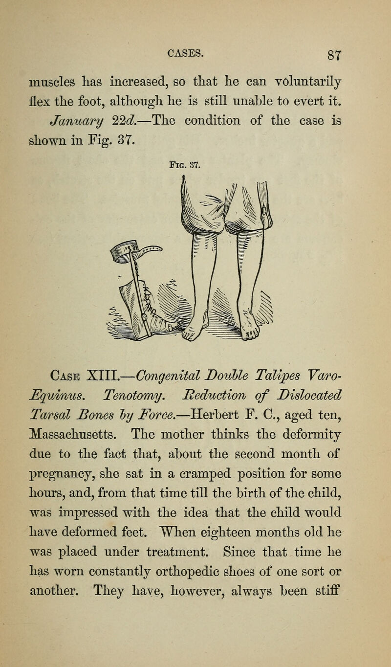 muscles has increased, so that he can voluntarily flex the foot, although he is still unable to evert it. Janioary 22d.—The condition of the case is shown in Fig. 37. Fig. 37. Case XIII.—Congenital Doiible Talipes Yaro- Equinus. Tenotomy. Reduction of Dislocated Tarsal Bones hy Force.—'Herbert F. C, aged ten, Massachusetts. The mother thinks the deformity- due to the fact that, about the second month of pregnancy, she sat in a cramped position for some hours, and, from that time till the birth of the child, was impressed with the idea that the child would have deformed feet. When eighteen months old he was placed under treatment. Since that time he has worn constantly orthopedic shoes of one sort or another. They have, however, always been stiff
