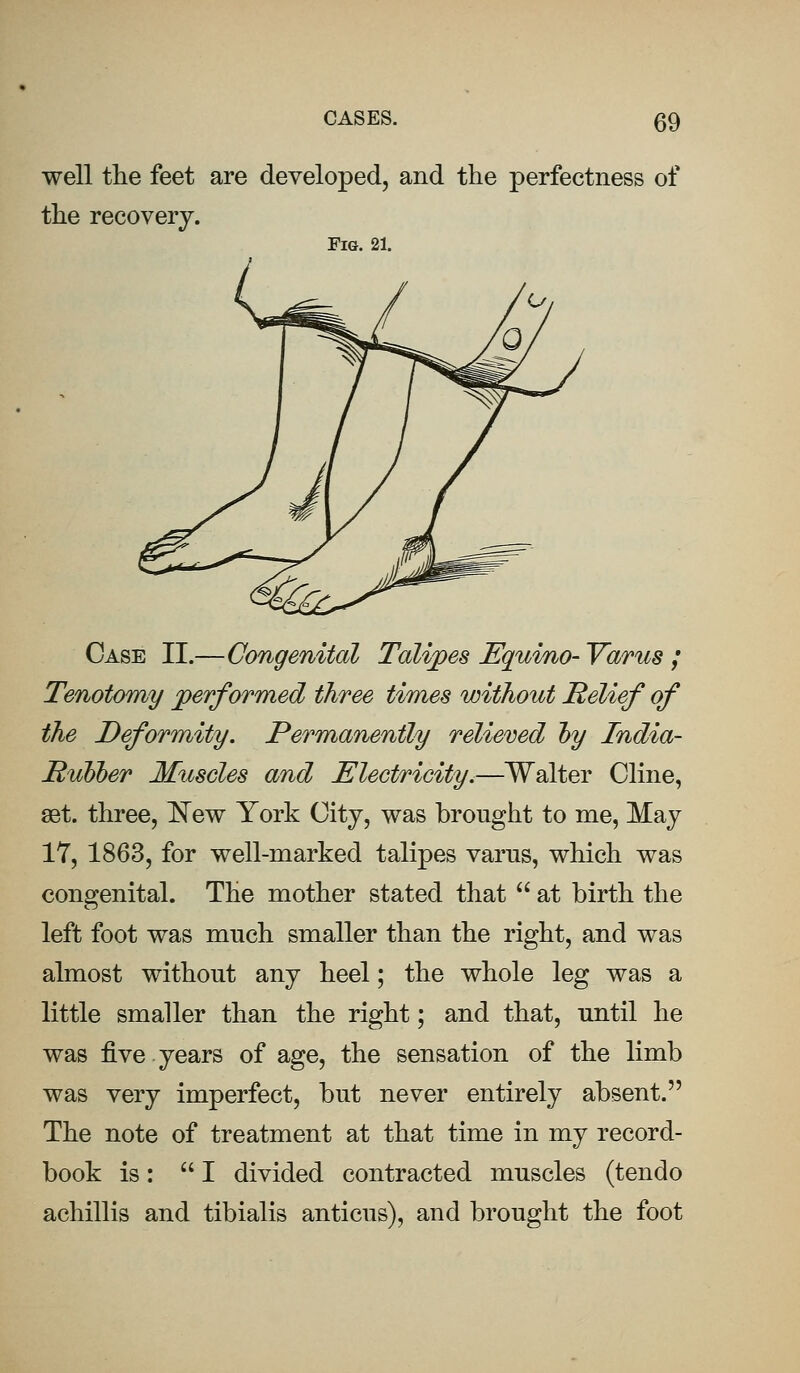 well the feet are developed, and the perfectness of the recovery. Fig. 21. Case II.—Congenital Talipes Equino- Yarns ; Tenotomy performed three times without Relief of the Deformity. Permanently relieved hy India- Rubber Muscles and Electricity.—Walter Cline, set. three, New York City, was brought to me, May 17, 1863, for well-marked talipes varus, which was congenital. The mother stated that  at birth the left foot was much smaller than the right, and was almost without any heel; the whole leg was a little smaller than the right; and that, until he was five years of age, the sensation of the limb was very imperfect, but never entirely absent. The note of treatment at that time in my record- book is: I divided contracted muscles (tendo achillis and tibialis anticus), and brought the foot