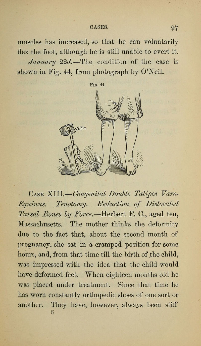 muscles has increased, so that he can voluntarily flex the foot, although he is still unable to evert it. January %2d.—The condition of the case is shown in Fig. 44, from photograph by O'Neil. Fig. 44. Case XIII.—Congenital Double Talipes Varo- Equinus. Tenotomy. Reduction of Dislocated Tarsal Bones by Force.—Herbert F. C, aged ten, Massachusetts. The mother thinks the deformity due to the fact that, about the second month of pregnancy, she sat in a cramped position for some hours, and, from that time till the birth of the child, was impressed with the idea that the child would have deformed feet. When eighteen months old he was placed under treatment. Since that time he has worn constantly orthopedic shoes of one sort or another. They have, however, always been stiff