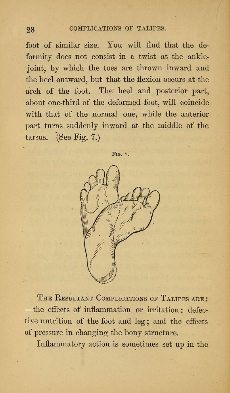 foot of similar size. You will find that the de- formity does not consist in a twist at the ankle- joint, by which the toes are thrown inward and the heel outward, but that the flexion occurs at the arch of the foot. The heel and posterior part, about one-third of the deformed foot, will coincide with that of the normal one, while the anterior part turns suddenly inward at the middle of the tarsus. (See Fig. 7.) Fig. ?.' The Resultant Complications of Talipes are : —the effects of inflammation or irritation; defec- tive nutrition of the foot and leg; and the effects of pressure in changing the bony structure. Inflammatory action is sometimes set up in the