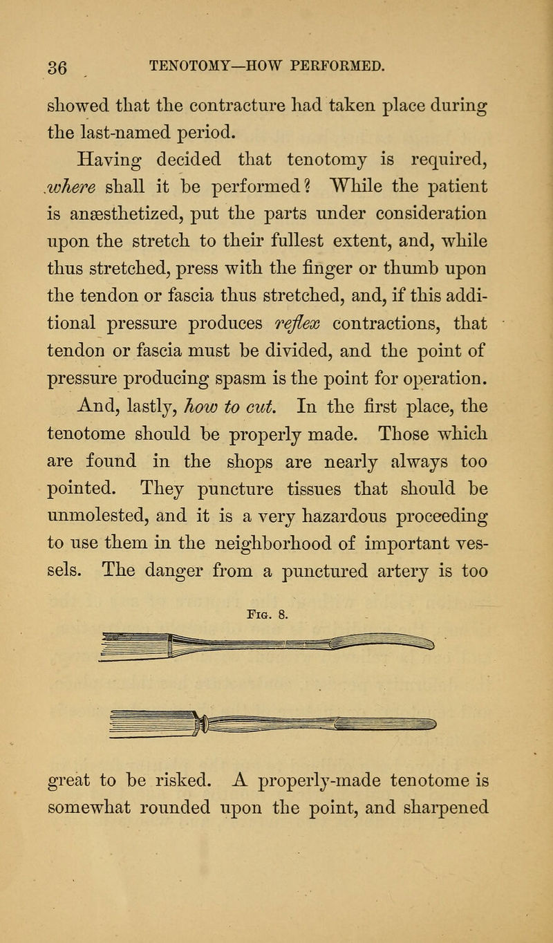 showed that the contracture had taken place during the last-named period. Having decided that tenotomy is required, .where shall it be performed? While the patient is anaesthetized, put the parts under consideration upon the stretch to their fullest extent, and, while thus stretched, press with the finger or thumb upon the tendon or fascia thus stretched, and, if this addi- tional pressure produces reflex contractions, that tendon or fascia must be divided, and the point of pressure producing spasm is the point for operation. And, lastly, how to cut In the first place, the tenotome should be properly made. Those which are found in the shops are nearly always too pointed. They puncture tissues that should be unmolested, and it is a very hazardous proceeding to use them in the neighborhood of important ves- sels. The danger from a punctured artery is too Fig. 8. great to be risked. A properly-made tenotome is somewhat rounded upon the point, and sharpened