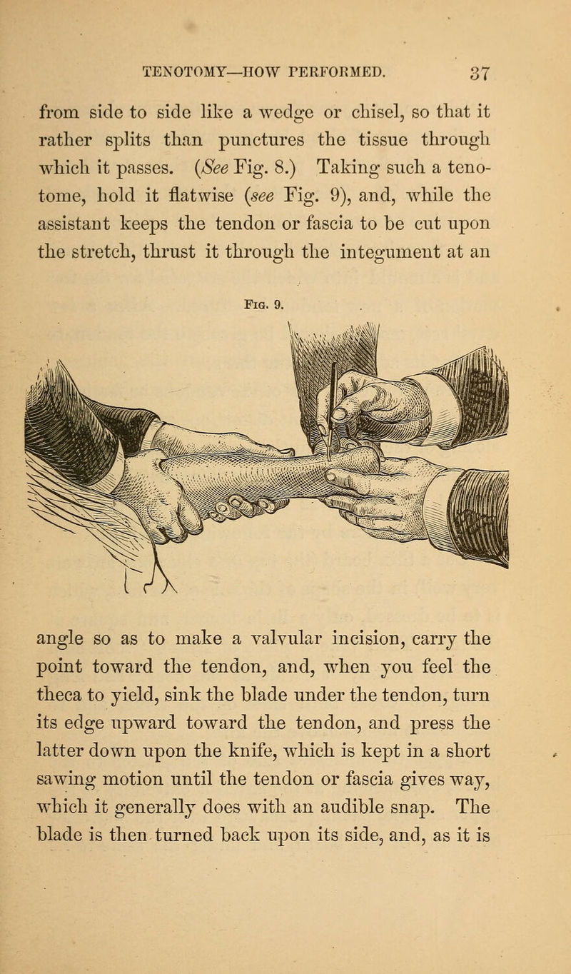 from side to side like a wedge or chisel, so that it rather splits than punctures the tissue through which it passes. {See Fig. 8.) Taking such a teno- tome, hold it flatwise {see Fig. 9), and, while the assistant keeps the tendon or fascia to be cut upon the stretch, thrust it through the integument at an Fig. 9. angle so as to make a valvular incision, carry the point toward the tendon, and, when you feel the theca to yield, sink the blade under the tendon, turn its edge upward toward the tendon, and press the latter down upon the knife, which is kept in a short sawing motion until the tendon or fascia gives way, which it generally does with an audible snap. The blade is then turned back upon its side, and, as it is