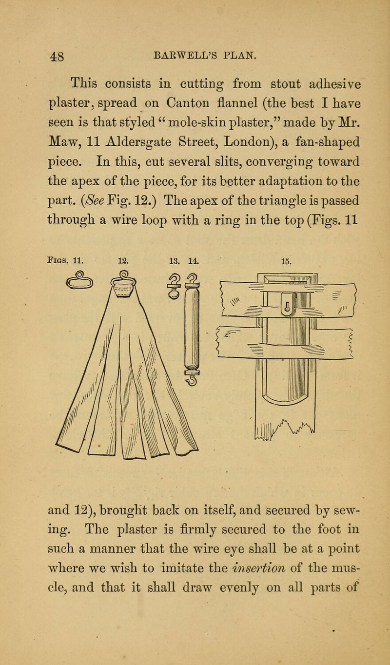 This consists in cutting from stout adhesive plaster, spread on Canton flannel (the best I have seen is that styled  mole-skin plaster, made by Mr. Maw, 11 Aldersgate Street, London), a fan-shaped piece. In this, cut several slits, converging toward the apex of the piece, for its better adaptation to the part. (See Fig. 12.) The apex of the triangle is passed through a wire loop with a ring in the top (Figs. 11 Figs. 11. 12. 13. 14. and 12), brought back on itself, and secured by sew- ing. The plaster is firmly secured to the foot in such a manner that the wire eye shall be at a point where we wish to imitate the insertion of the mus- cle, and that it shall draw evenly on all parts of