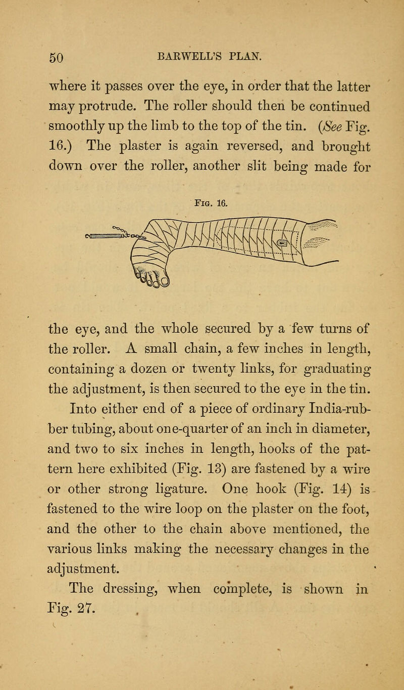 where it passes over the eye, in order that the latter may protrude. The roller should then be continued smoothly up the limb to the top of the tin. {See Fig. 16.) The plaster is again reversed, and brought down over the roller, another slit being made for Fig. 16. the eye, and the whole secured by a few turns of the roller. A small chain, a few inches in length, containing a dozen or twenty links, for graduating the adjustment, is then secured to the eye in the tin. Into either end of a piece of ordinary India-rub- ber tubing, about one-quarter of an inch in diameter, and two to six inches in length, hooks of the pat- tern here exhibited (Fig. 13) are fastened by a wire or other strong ligature. One hook (Fig. 14) is fastened to the wire loop on the plaster on the foot, and the other to the chain above mentioned, the various links making the necessary changes in the adjustment. The dressing, when complete, is shown in Fig. 27.
