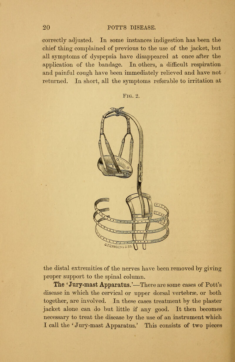 correctly adjusted. In some instances indigestion has been the chief thing complained of previous to the use of the jacket, but all symptoms of dyspepsia have disappeared at once after the application of the bandage. In others, a difficult respiration and painful cough have been immediately relieved and have not retiu-ned. In short, all the symptoms referable to irritation at Fig. 2. the distal extremities of the nerves have been removed by giving proper support to the spinal column. The 'Jury-mast Apparatus.'—There are some cases of Pott's disease in which the cervical or upj^er dorsal vertebrae, or both together, are involved. In these cases treatment by the plaster jacket alone can do but little if any good. It then becomes necessary to treat the disease by the use of an instrument which I call the 'Jury-mast Apparatus.' This consists of two pieces