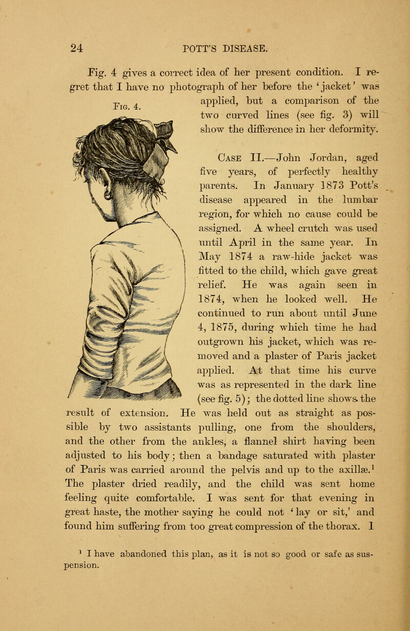 Pig. 4 gives a correct idea of her present condition. I re- gret that I have no photograph of her before the 'jacket' was applied, but a comparison of the two curved lines (see fig. 3) will show the difference in her deformity. Fig. 4. Case II,—John Jordan, aged five years, of perfectly healthy parents. In January 1873 Pott's disease appeared in the lumbar region, for which no cause could be assigned. A wheel crutch was used until April in the same year. In May 1874 a raw-hide jacket was fitted to the child, which gave great relief. He was again seen in 1874, when he looked well. He continued to run about until June 4, 1875, during which time he had outgrown his jacket, which was re- moved and a plaster of Paris jacket ajDplied. At that time his curve was as represented in the dark Hne (see fig. 5); the dotted line shows, the result of extension. He was held out as straight as pos- sible by two assistants pulling, one from the shoulders, and the other from the ankles, a flannel shirt having been adjusted to his body; then a bandage saturated with plaster of Paris was carried around the pelvis and up to the axillae.^ The plaster dried readily, and the child was sent home feeling quite comfortable. I was sent for that evening in great haste, the mother saying he could not ' lay or sit,' and found him suffering from too great compression of the thorax. I ^ I have abandoned this plan, as it is not so good or safe as sus- pension.