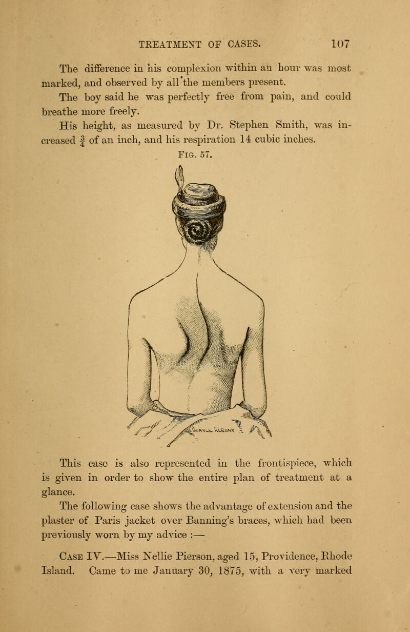 Tlie difference in his complexion within an hour was most marked, and observed by all'the members present. The boy said he was perfectly free from pain, and could breathe more freely. His height, as measured by Dr. Stephen Smith, was in- creased J of an inch, and his respiration 14 cubic inches. Fi&. 57. This case is also represented in the frontispiece, which is given in order to show the entire plan of treatment at a glance. The following case shows the advantage of extension and the plaster of Paris jacket over Banning's braces, which had been previously worn by my ad^dce :— Case IY.—Miss Nellie Pierson, aged 15, Providence, Rhode Island. Came to me January 30, 1875, with a very marked