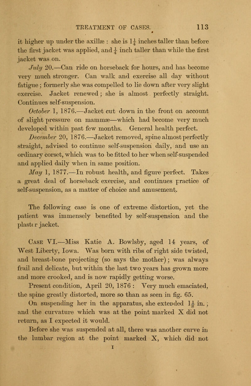 it higher up under the axillae : she is 1^ inches taller than before the first jacket was applied, and ^ inch taller than while the first jacket was on. Jiily 20.—Can ride on horseback for hours, and has become very much stronger. Can walk and exercise all day without fatigue; formerly she was compelled to lie down after very slight exercise. Jacket renewed; she is almost perfectly straight. Continues self-suspension. October 1, 1876.—Jacket cut down in the front on account of slight pressure on mammae—which had become very much developed within past few months. General health perfect. December 20, 1876.—Jacket removed, spine almost perfectly straight, advised to continue self-snspension daily, and use an ordinary corset, which was to be fitted to her when self-suspended and applied daily when in same position. May 1, 1877.—In robust health, and figure perfect. Takes a great deal of horseback exercise, and continues practice of self-suspension, as a matter of choice and amusement. The following case is one of extreme distortion, yet the patient was immensely benefited by self-suspension and the plasttr jacket. Case YI.—Miss Katie A. Bowlsby, aged 14 years, of West Liberty, Iowa. Was born with ribs of right side twisted, and breast-bone projecting (so says the mother); was always frail and delicate, but within the last two years has grown more and more crooked, and is now rapidly getting worse. Present condition, April 20, 1876 : Yery much emaciated, the spine greatly distorted, more so than as seen in fig. 65. On suspending her in the apparatus, she extended 1^ in.; and the curvature which was at the point marked X did not return, as I expected it would. Before she was suspended at all, there was another curve in the lumbar region at the point marked X, which did not I