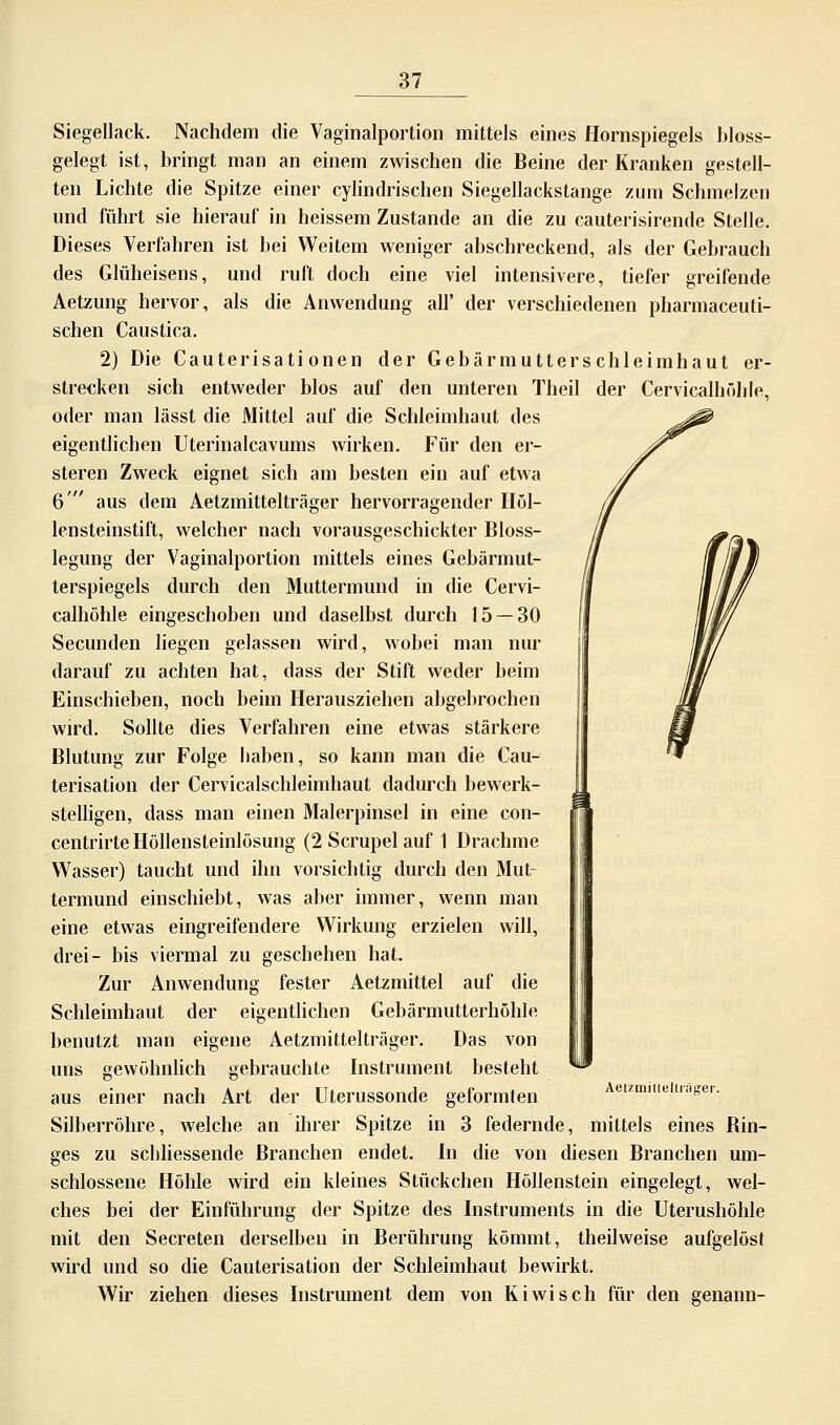 Siegellack. Nachdem die Vaginalportion mittels eines Hornspiegels bloss- gelegt ist, bringt man an einem zwischen die Beine der Kranken gestell- ten Lichte die Spitze einer cylindrischen Siegellackstange zum Schmelzen und führt sie hierauf in heissem Zustande an die zu cauterisirende Stelle. Dieses Verfahren ist bei Weitem weniger abschreckend, als der Gebrauch des Glüheisens, und ruft doch eine viel intensivere, tiefer greifende Aetzung hervor, als die Anwendung all' der verschiedenen pharmaceuti- schen Caustica. 2) Die Cauterisati onen der Gebärmutterschleimhaut er- strecken sich entweder blos auf den unteren Theil der Cervicalhühle, oder man lässt die Mittel auf die Schleimhaut des eigentlichen Uterinalcavums wirken. Für den er- steren Zweck eignet sich am besten ein auf etwa 6 aus dem Aetzmittelträger hervorragender Höl- lensteinstift, welcher nach vorausgeschickter Bloss- legung der Vaginalportion mittels eines Gebärmut- terspiegels durch den Muttermund in die Cervi- calhöhle eingeschoben und daselbst durch 15 — 30 Secunden liegen gelassen wird, wobei man nur darauf zu achten hat, dass der Stift weder beim Einschieben, noch beim Herausziehen abgebrochen wird. Sollte dies Verfahren eine etwas stärkere Blutung zur Folge baben, so kann man die Cau- terisation der Cervicalschleimhaut dadurch bewerk- stelligen, dass man einen Malerpinsel in eine con- centrirte Höllensteinlösung (2Scrupelauf 1 Drachme Wasser) taucht und ihn vorsichtig durch den Mut- termund einschiebt, was aber immer, wenn man eine etwas eingreifendere Wirkung erzielen will, drei- bis viermal zu geschehen hat. Zur Anwendung fester Aetzmittel auf die Schleimhaut der eigentlichen Gebärmutterhöhle benutzt man eigene Aetzmittelträger. Das von uns gewöhnlich gebrauchte Instrument besteht aus einer nach Art der Uterussonde geformten Aemniueitrsger. Silberröhre, welche an ihrer Spitze in 3 federnde, mittels eines Bin- ges zu schliessende Branchen endet. In die von diesen Branchen um- schlossene Höhle wird ein kleines Stückchen Höllenstein eingelegt, wel- ches bei der Einführung der Spitze des Instruments in die Uterushöhle mit den Secreten derselben in Berührung kömmt, theilweise aufgelöst wird und so die Cauterisation der Schleimhaut bewirkt. Wir ziehen dieses Instrument dem von Kiwi seh für den genann-
