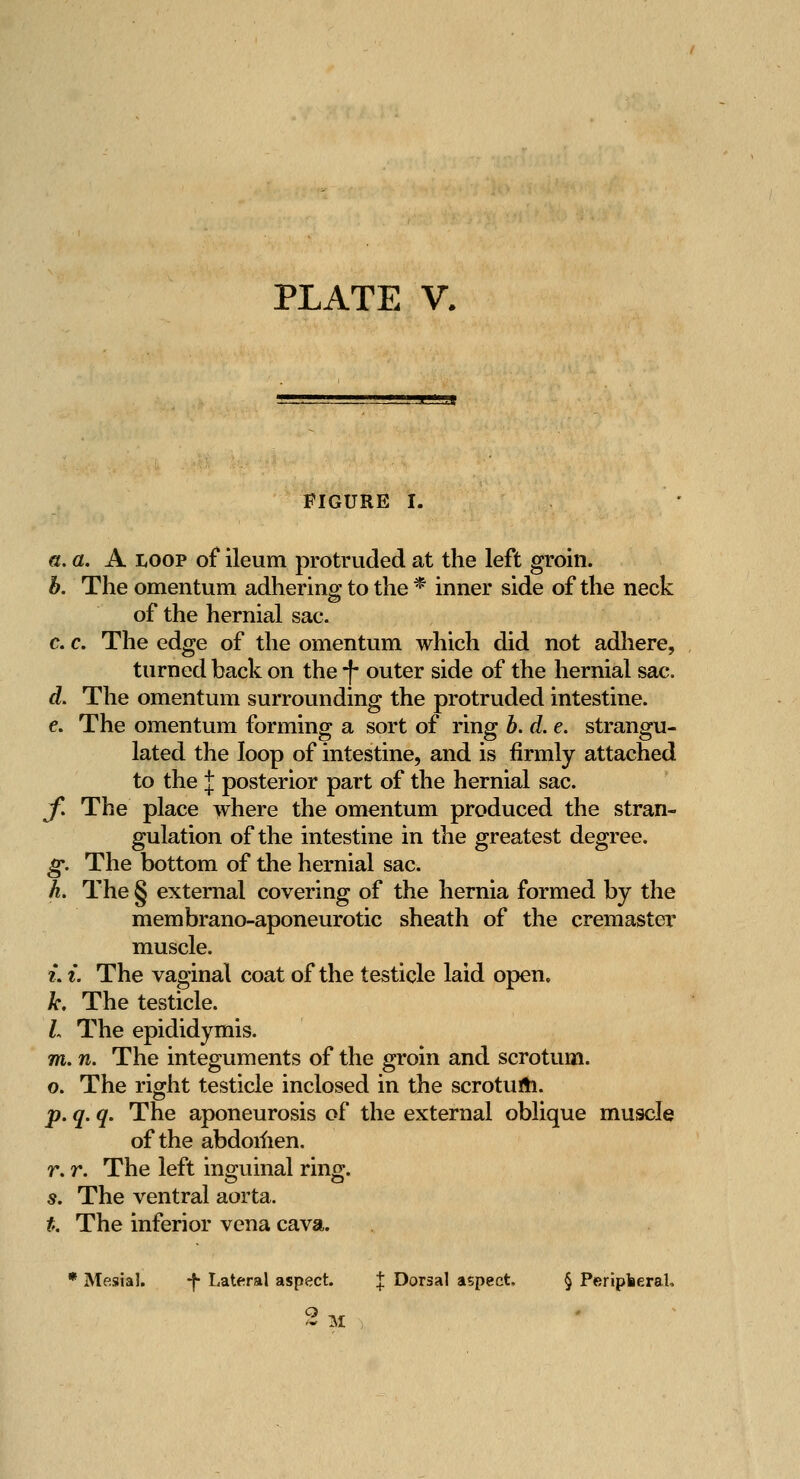 FIGURE I. G. a. A LOOP of ileum protruded at the left groin. b. The omentum adhering to the * inner side of the neck of the hernial sac. c. c. The edge of the omentum which did not adhere, turned back on the f outer side of the hernial sac. d. The omentum surrounding the protruded intestine. e. The omentum forming a sort of ring h. d. e. strangu- lated the loop of intestine, and is firmly attached to the J posterior part of the hernial sac. f. The place where the omentum produced the stran- gulation of the intestine in the greatest degree. g. The bottom of the hernial sac. h. The § external covering of the hernia formed by the membrano-aponeurotic sheath of the cremaster muscle. ?. {. The vaginal coat of the testicle laid open. k. The testicle. /- The epididymis. m. n. The integuments of the groin and scrotum. o. The right testicle inclosed in the scroturti. p. q. q. The aponeurosis of the external oblique muscle of the abdoilien. r. r. The left ino^uinal rino^. s. The ventral aorta. t. The inferior vena cava. • Mesial. -f Lateral aspect. | Dorsal aspect, § PerlplieraU